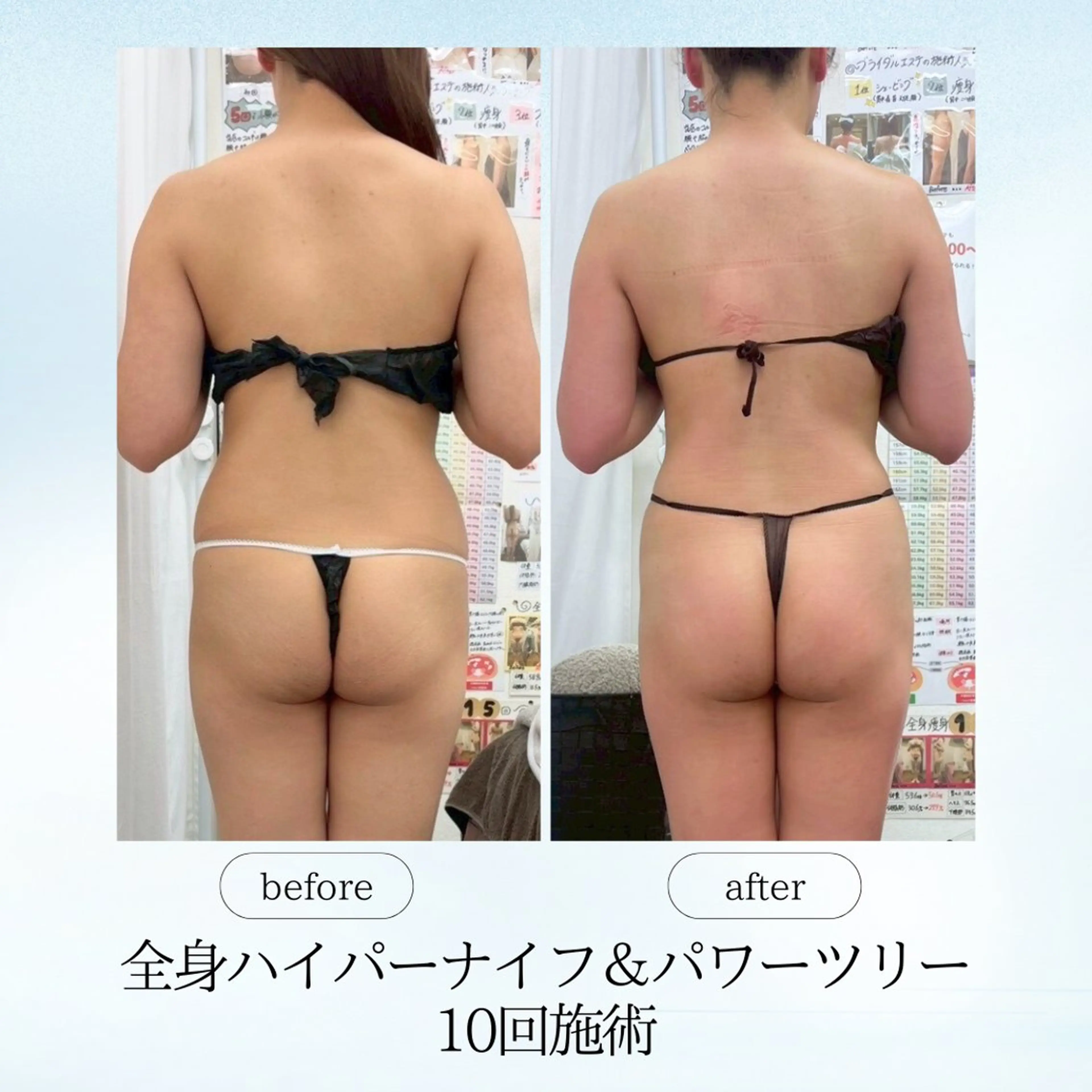 エステ リラク 《痩身、小顔専門店》 エスプレッソのエステ・リラクイメージ