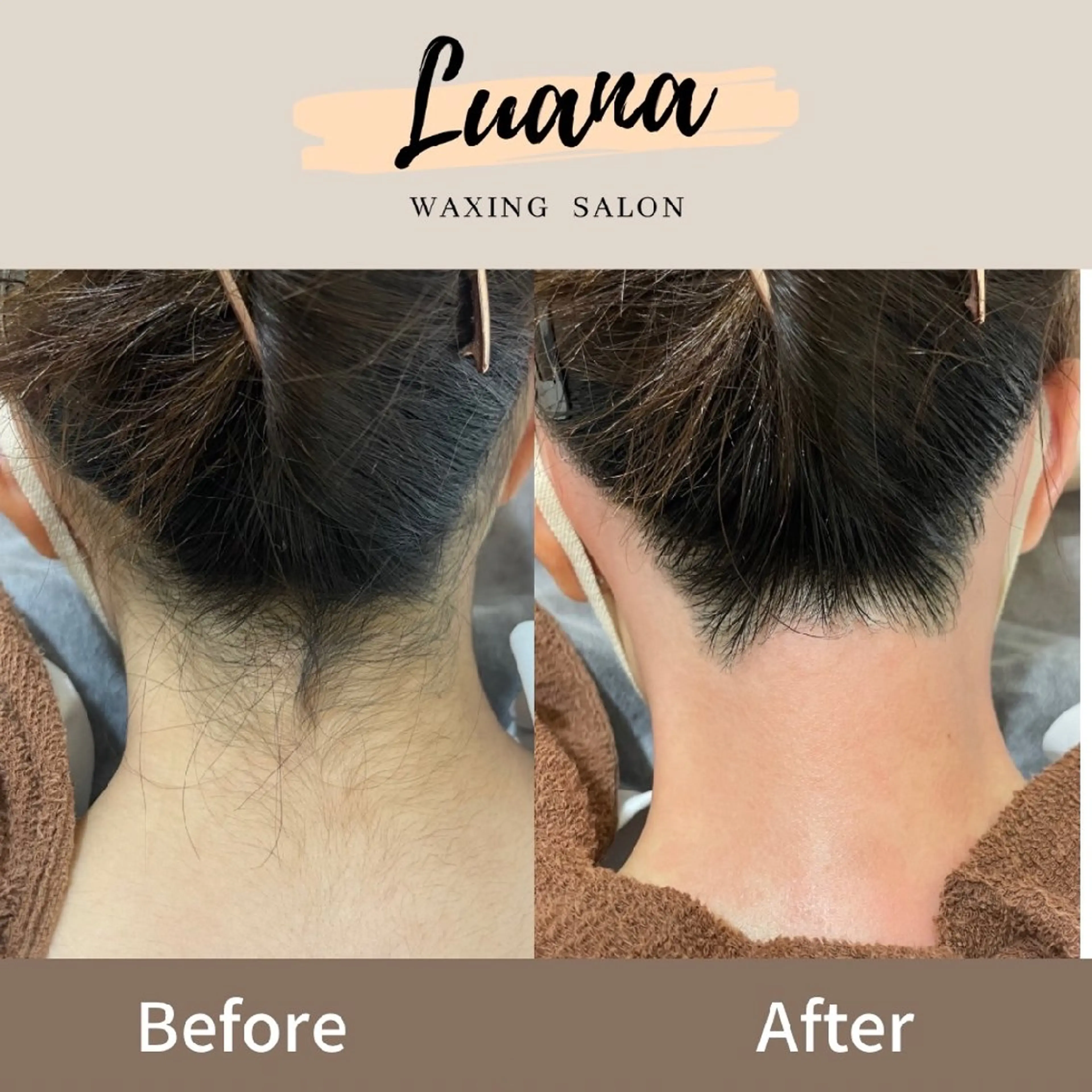 脱毛 Luana waxing salon所属・Luana wax 🐚根本のエステ・リラクイメージ