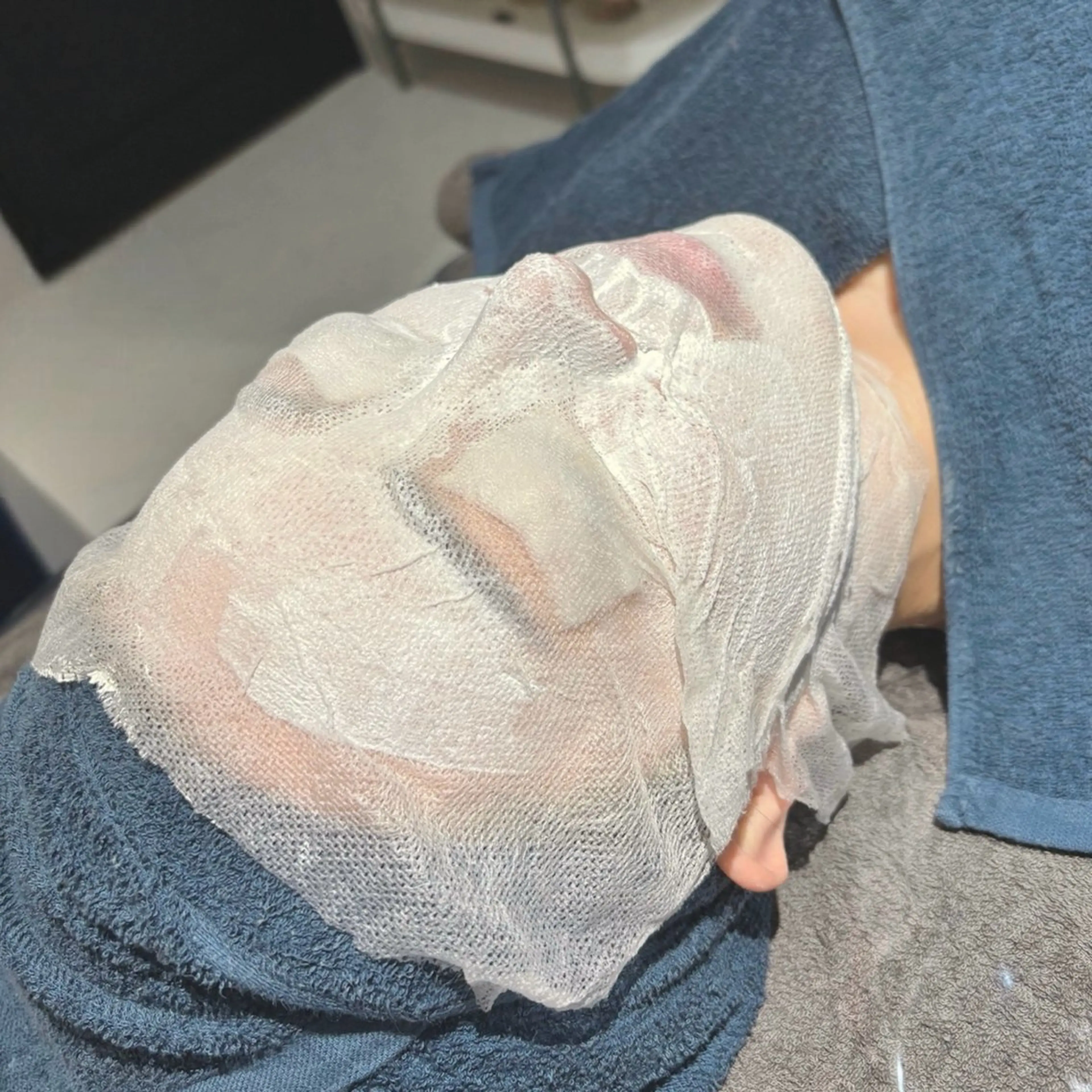 ハーブピーリング(顔)💎平日限定割‼️の写真