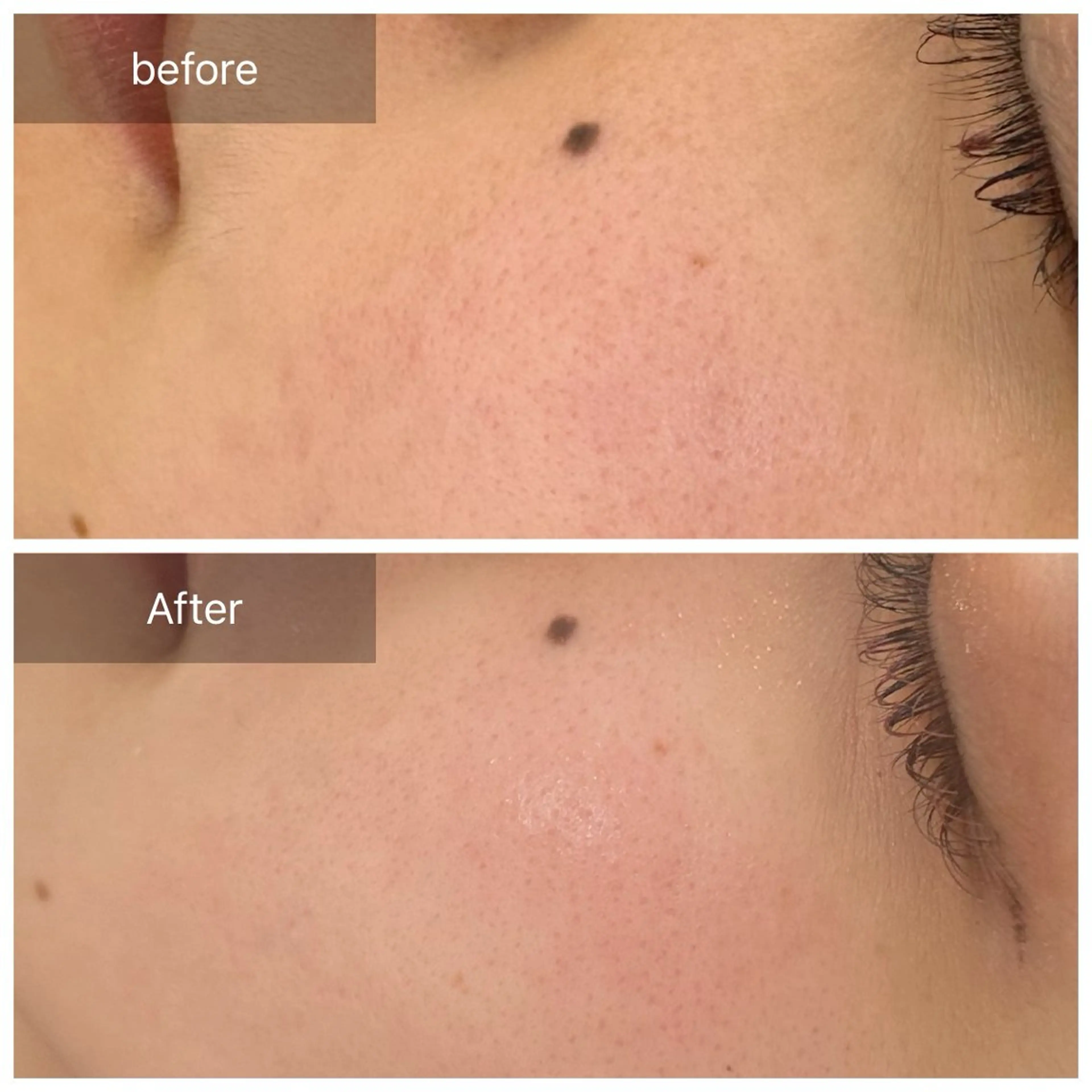 エステ トータルしみケア専門 NICA(ニカ)の眉毛・アイブロウイメージ