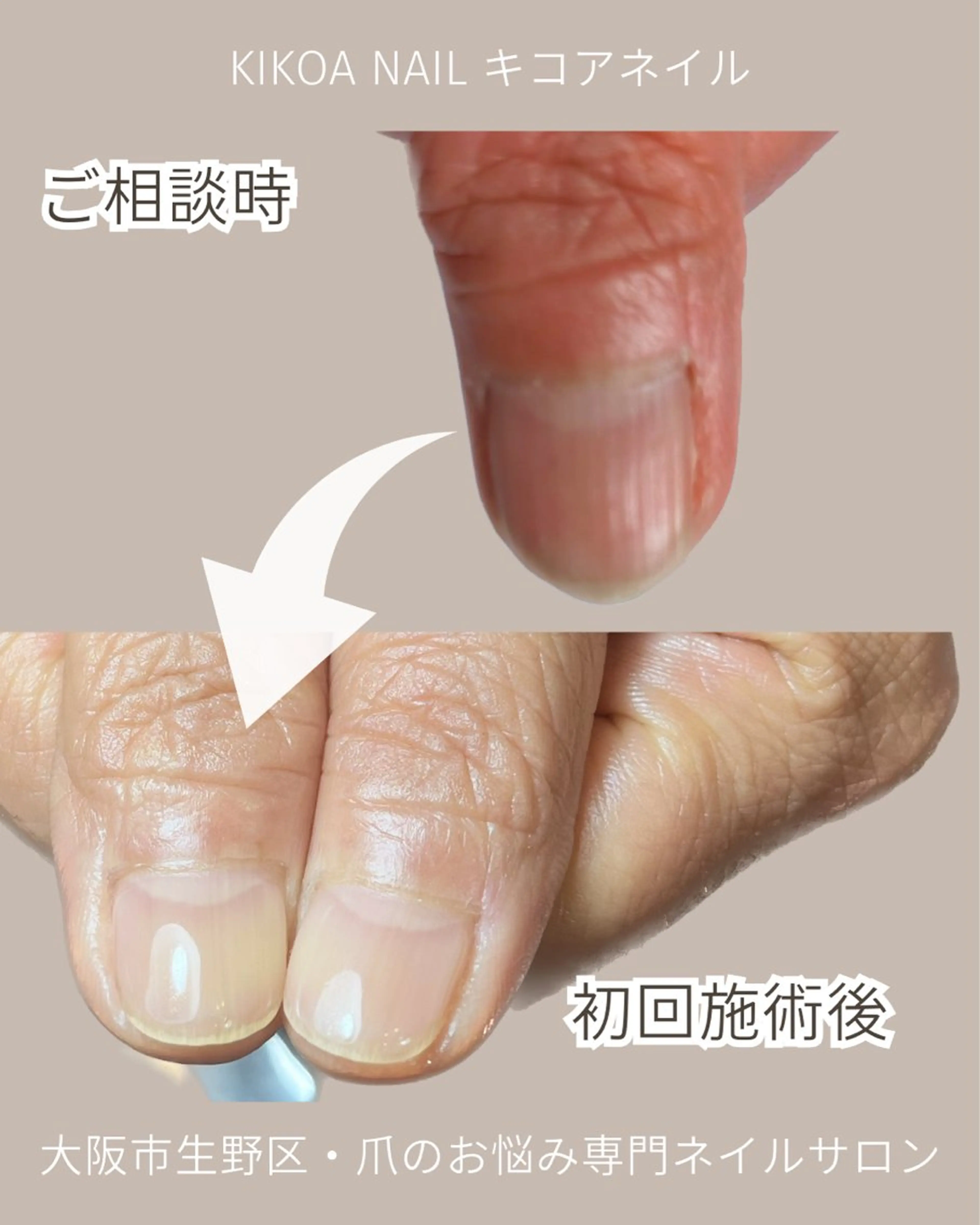 ネイル メンズネイル KIKOA NAIL キコアネイルのネイルデザイン