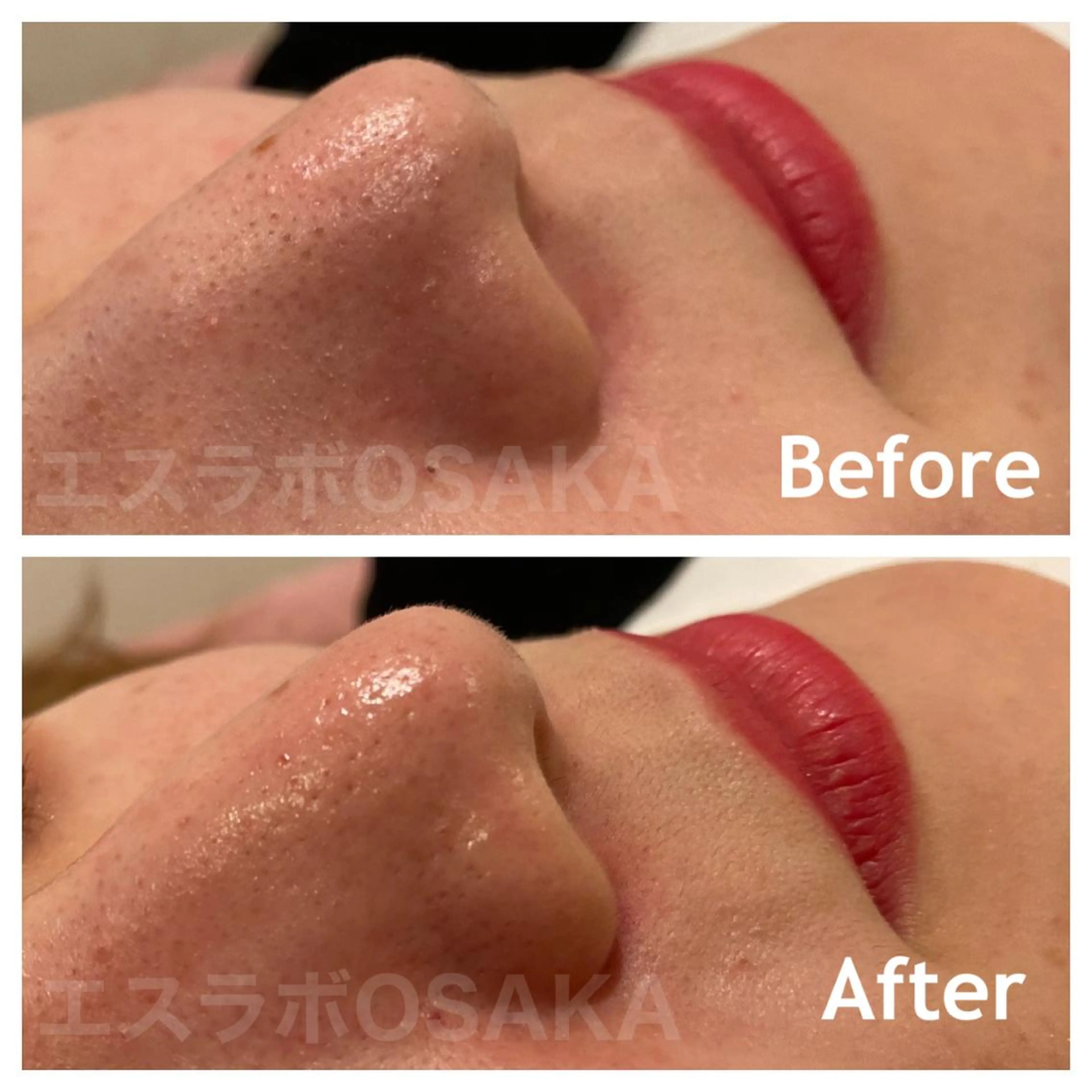 エスラボOSAKA 心斎橋のエステ・リラクイメージ