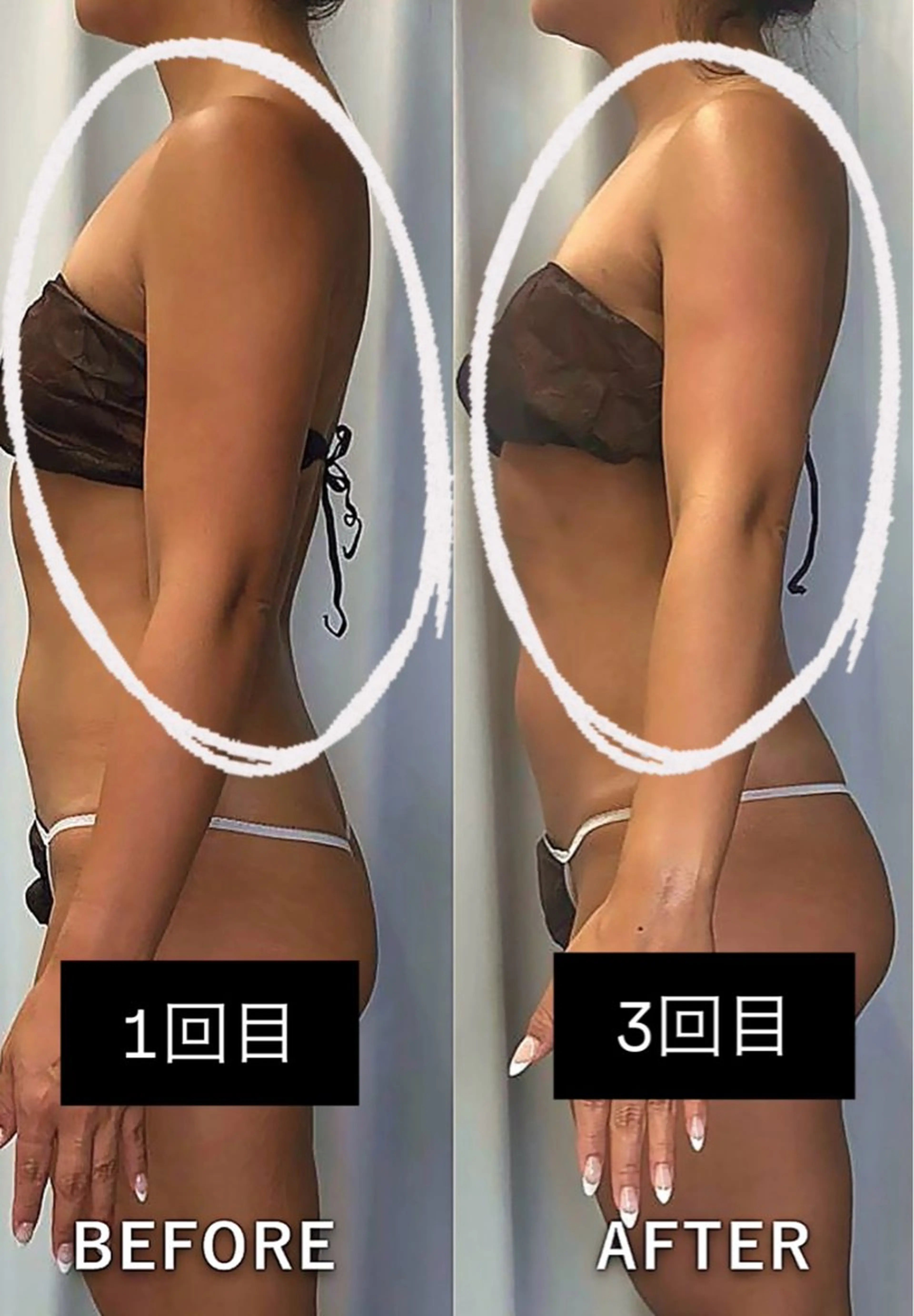 エステ 美容整体・塗る漢方・フェイシャルRechica所属・痩身・脱毛・肌管理 Rechica心斎橋のエステ・リラクイメージ