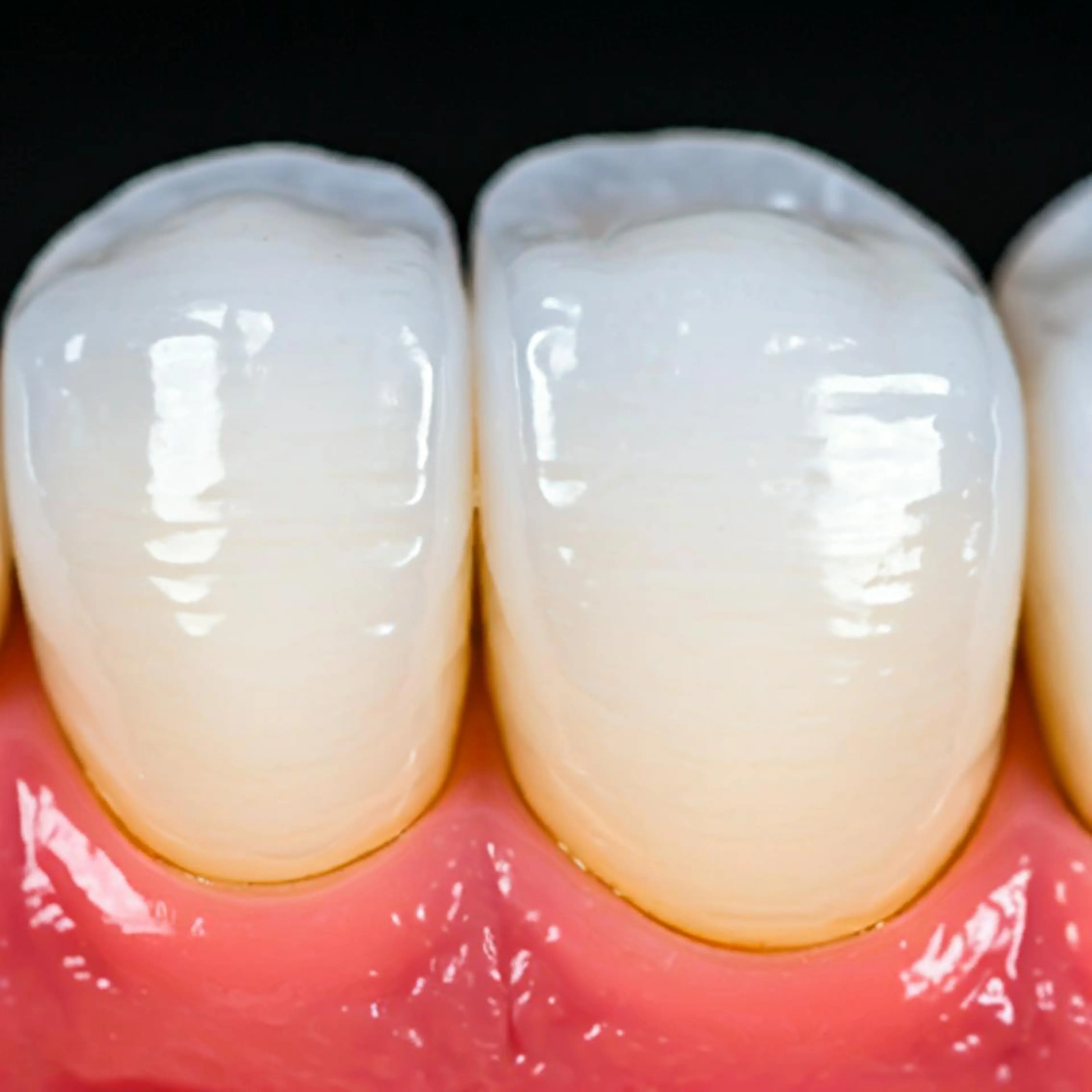 その他 ホワイトニングサロン nico西葛西店のその他イメージ