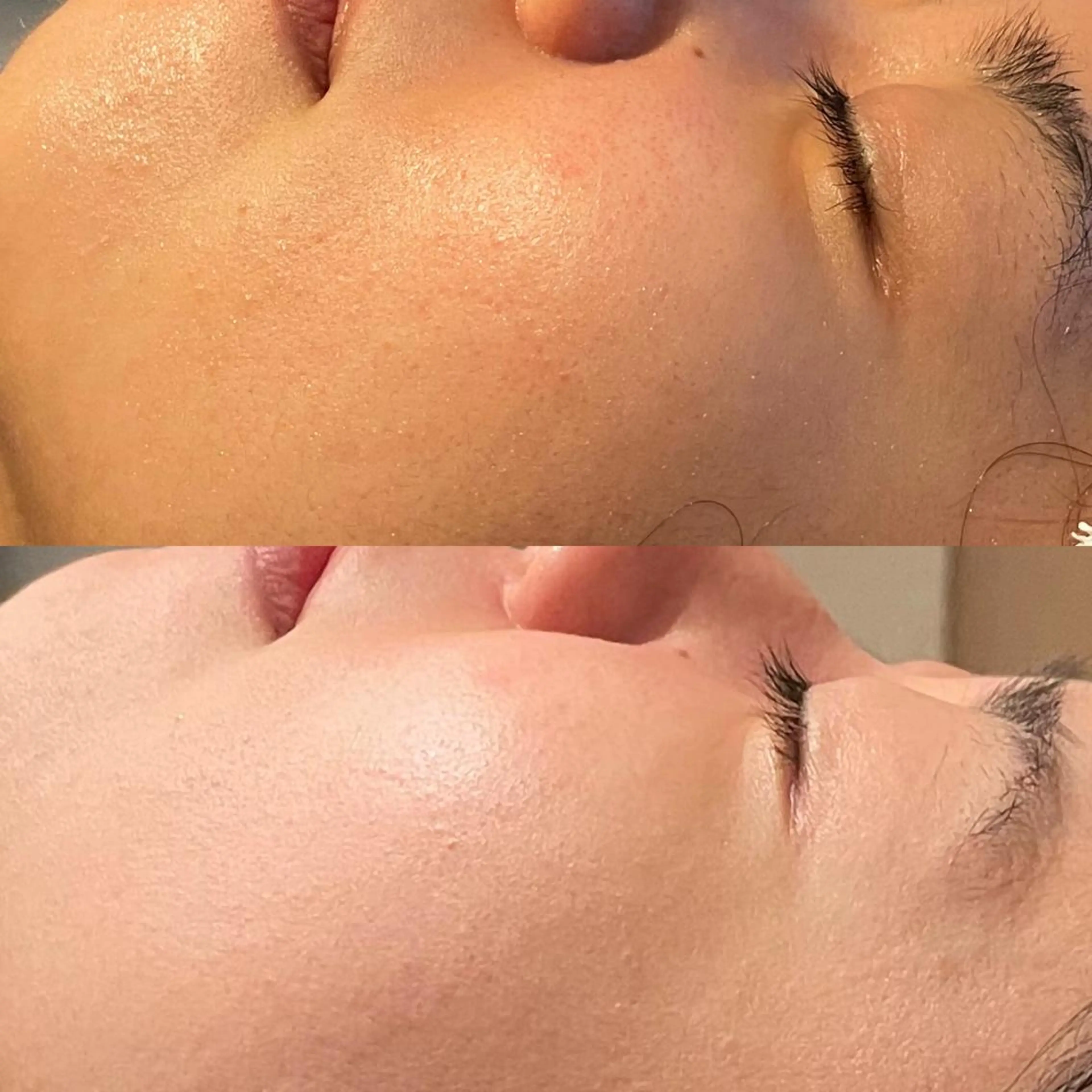 素肌キレイLab.所属・≪ニキビケア≫ 素肌キレイLab.のエステ・リラクイメージ