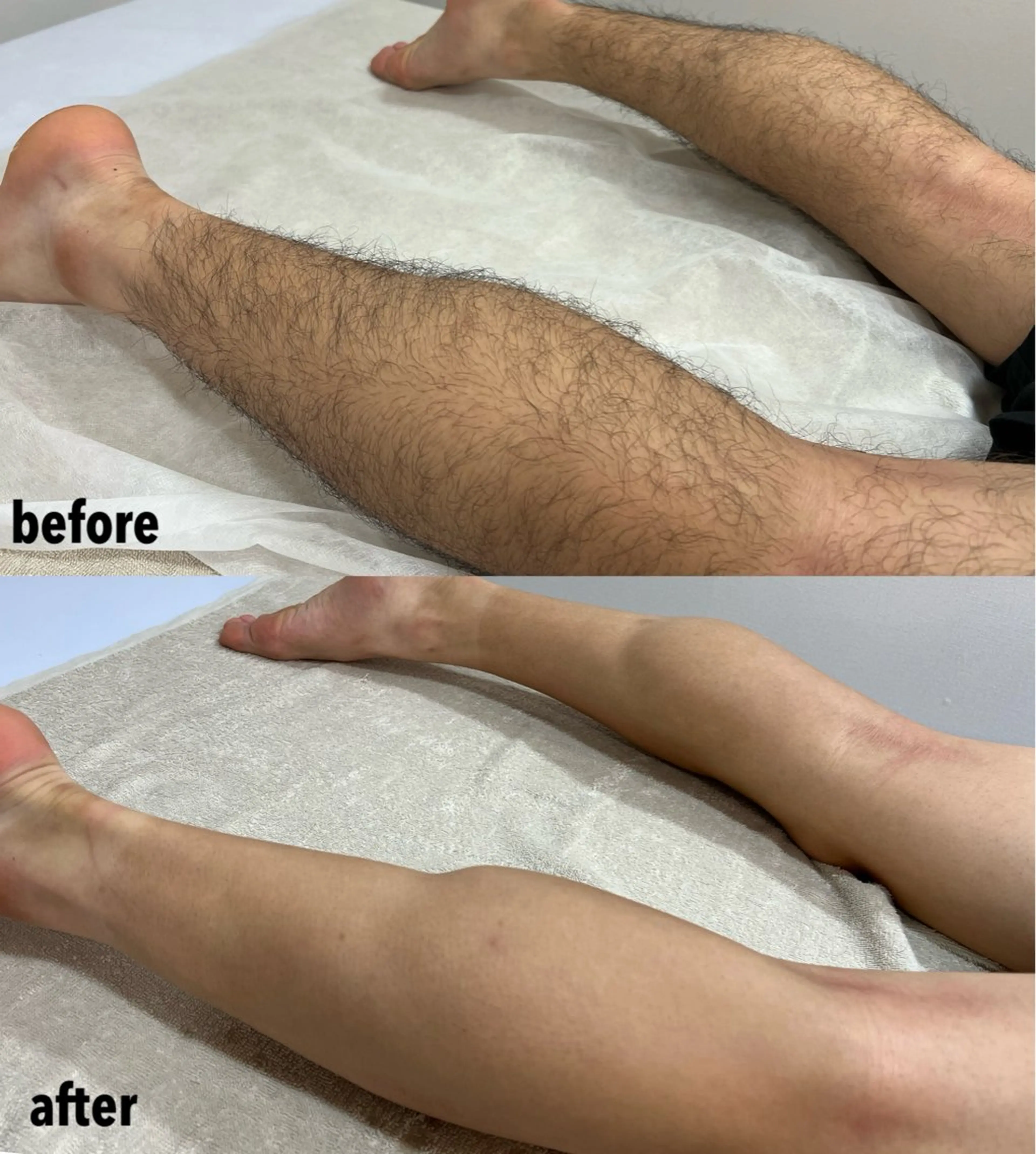 メンズ 脱毛 瀬戸 梨子のエステ・リラクイメージ