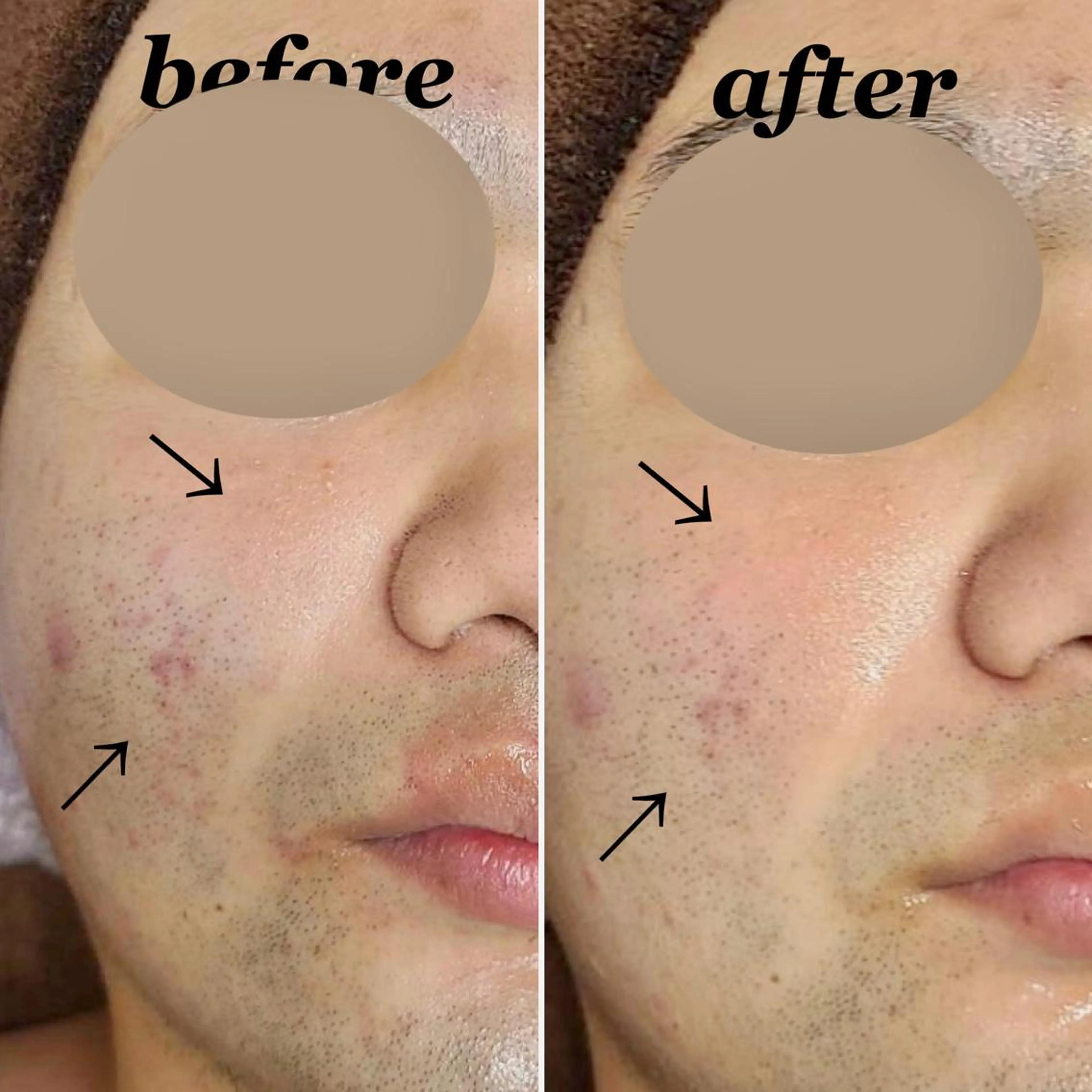 メンズ total beauty DIAのネイルデザイン