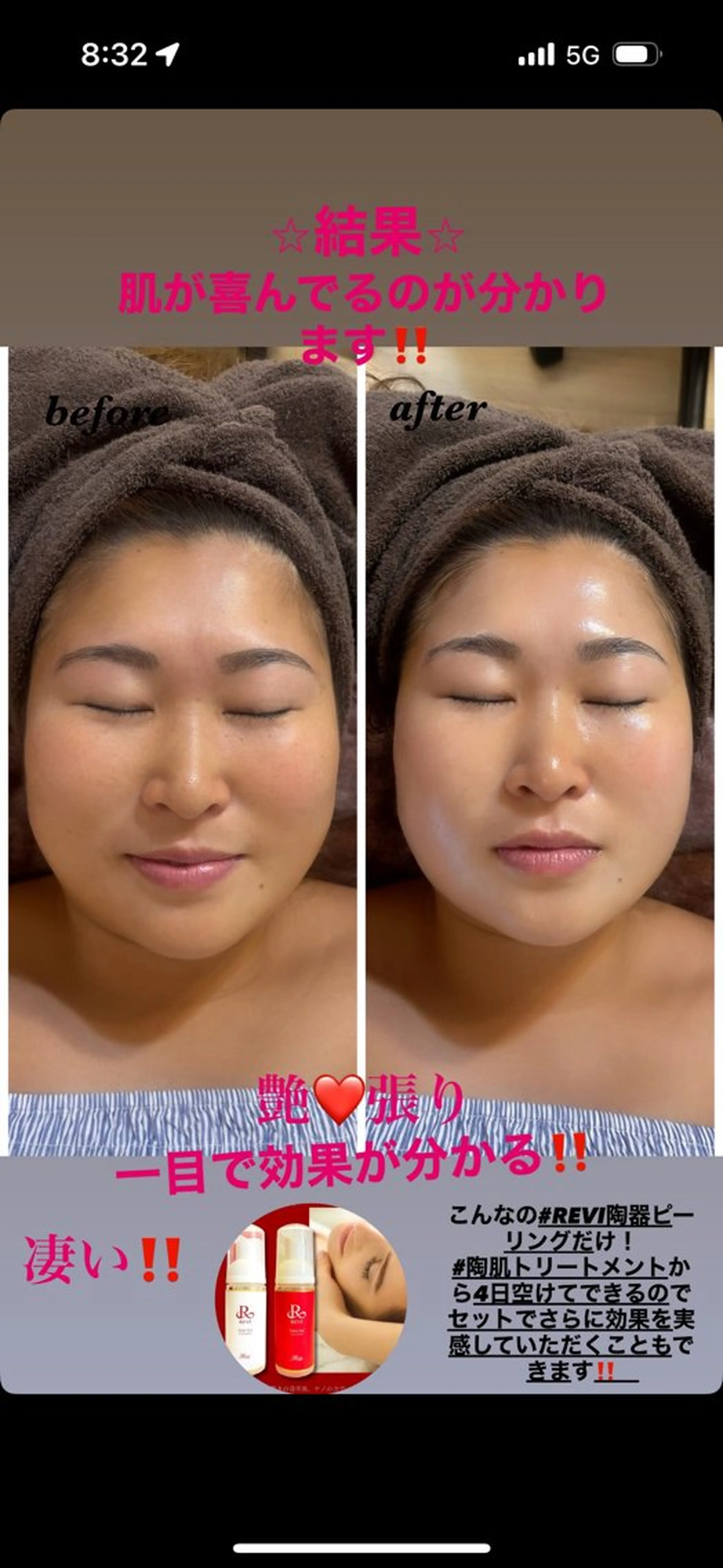 エステ ハーブピーリング専門 毛穴洗浄❤️眉waxのエステ・リラクイメージ