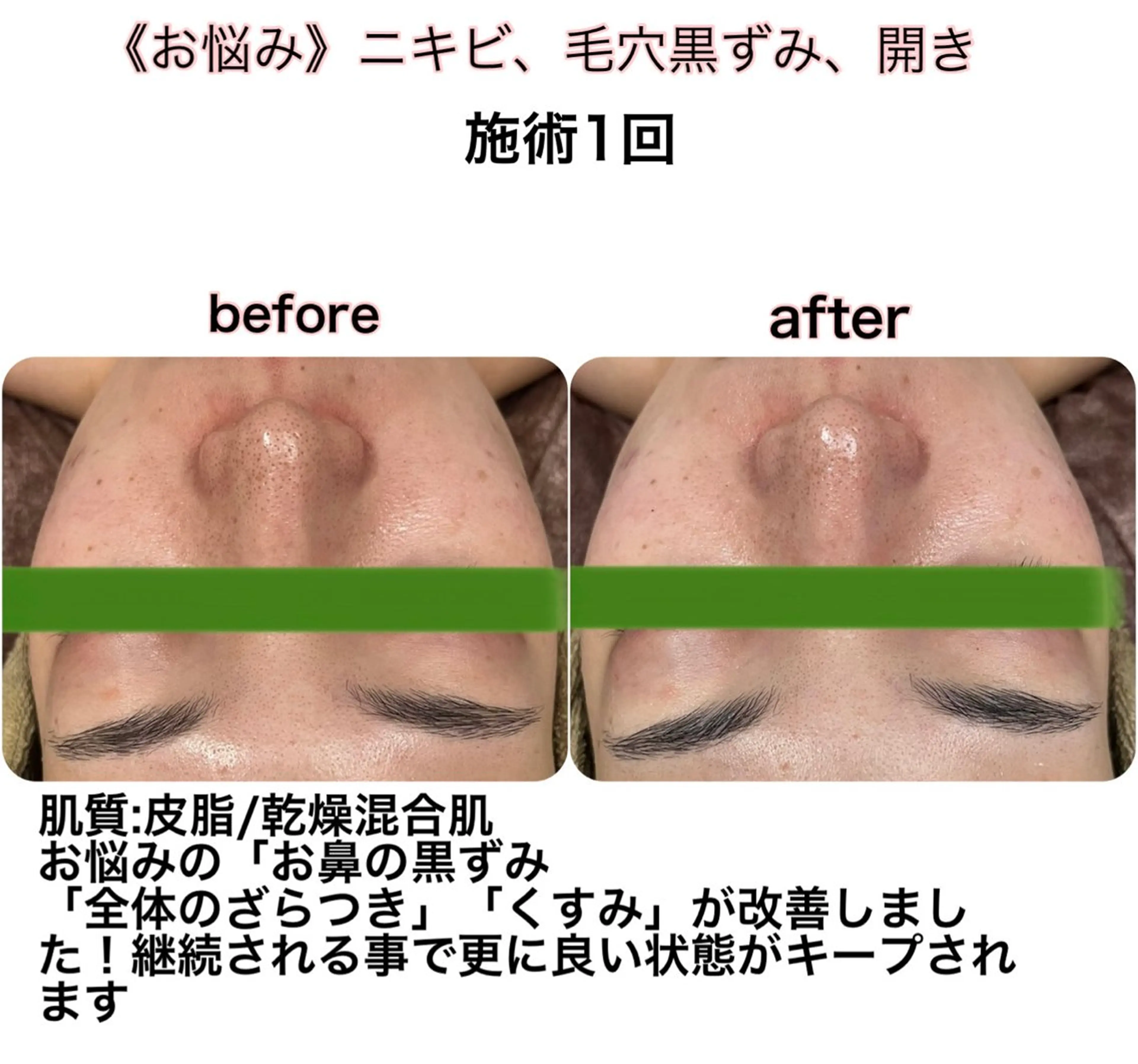 小顔&美肌品川店 Masqueradeのエステ・リラクイメージ