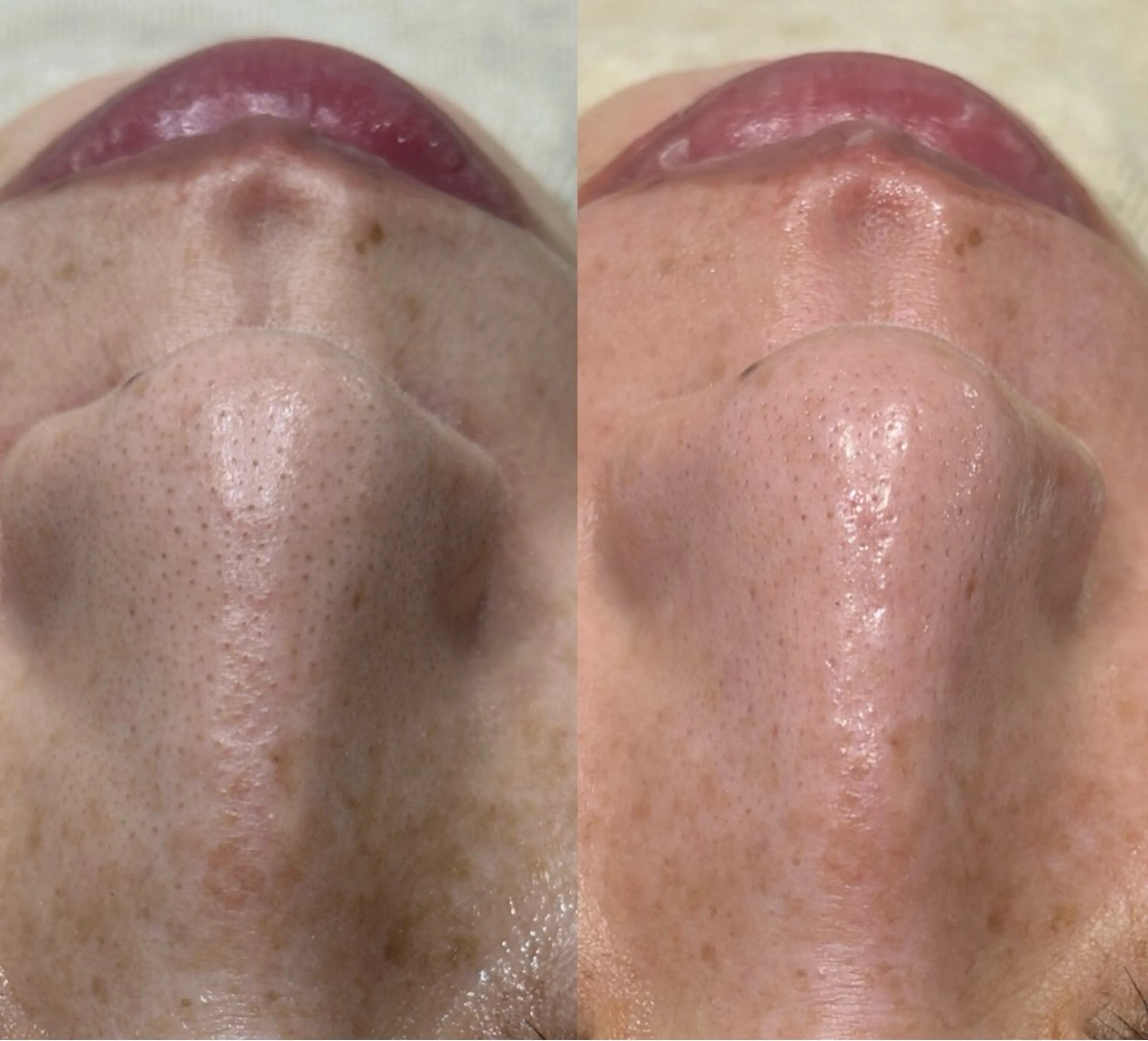 毛穴に特化したサロン MYFAIRLADYのエステ・リラクイメージ