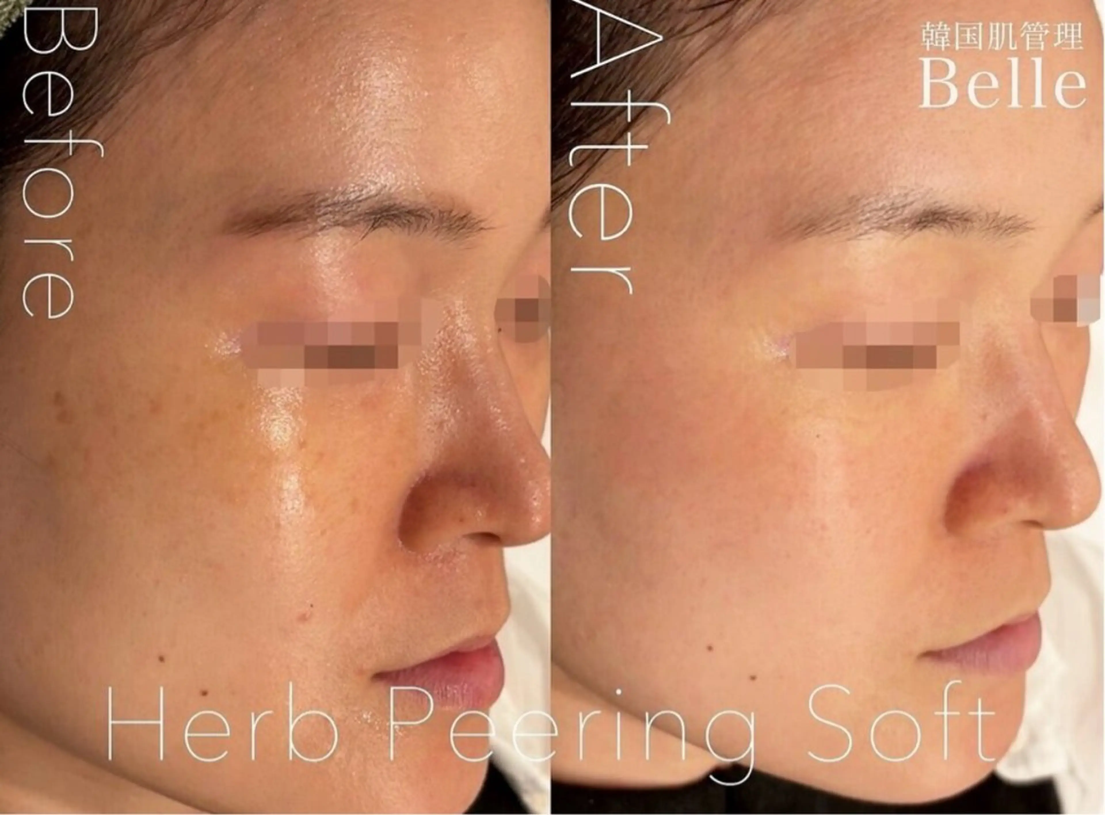 韓国肌管理Belle堀江所属・韓国肌管理 Belle堀江のエステ・リラクイメージ