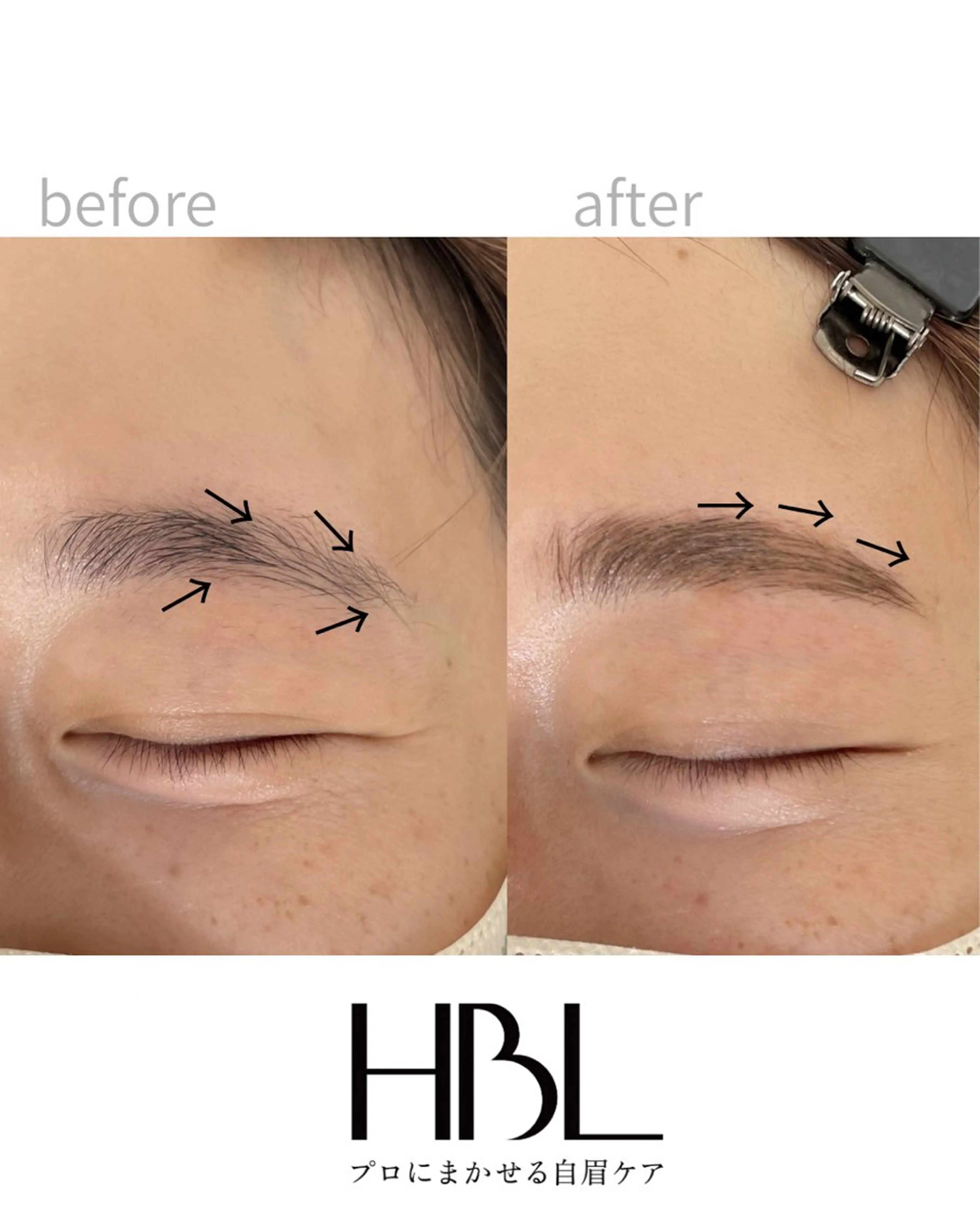 新HBL《美容液＋仕上げのメイク付き》の写真