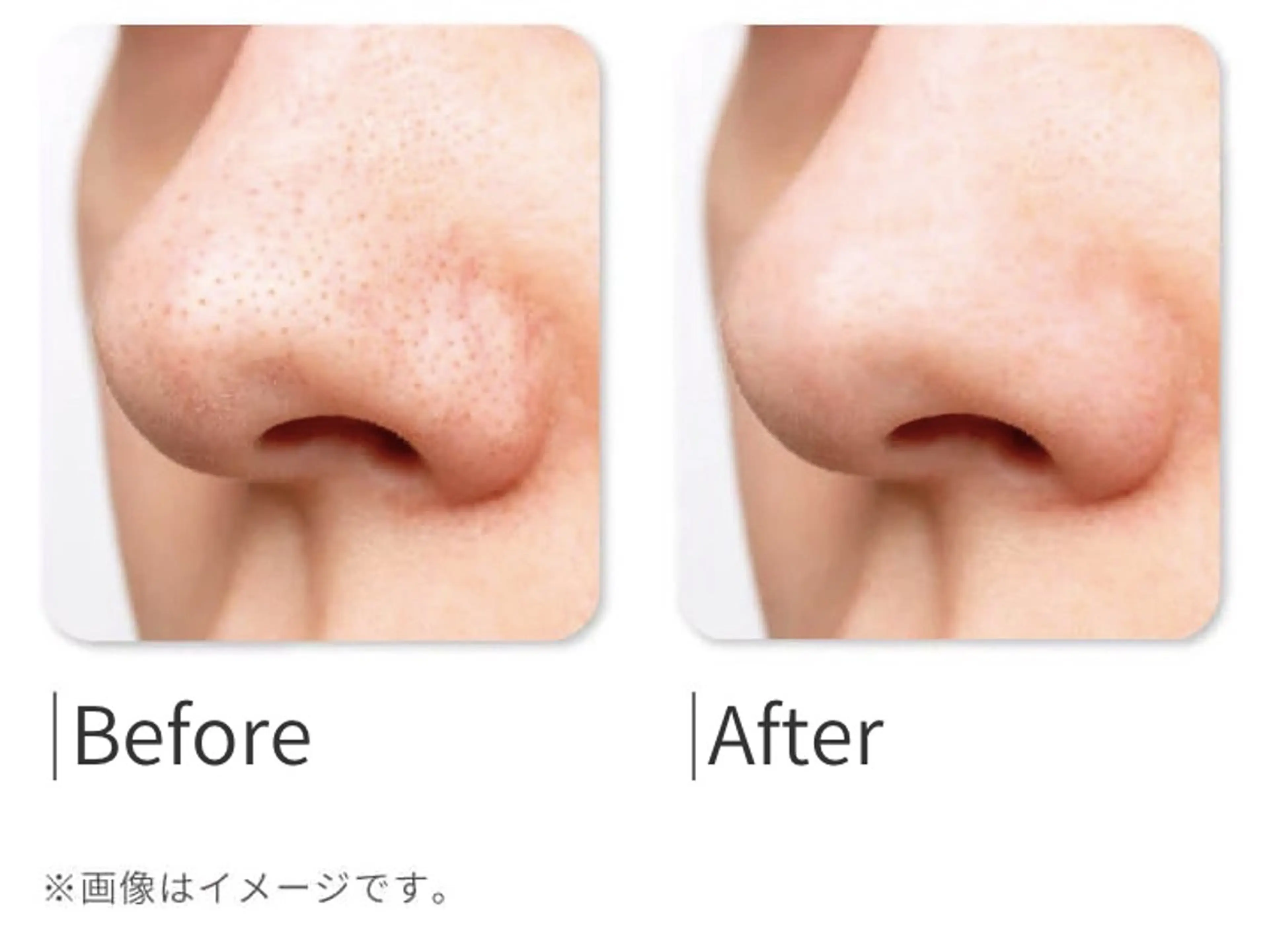 leolo武蔵浦和 肌質改善＆脱毛のエステ・リラクイメージ