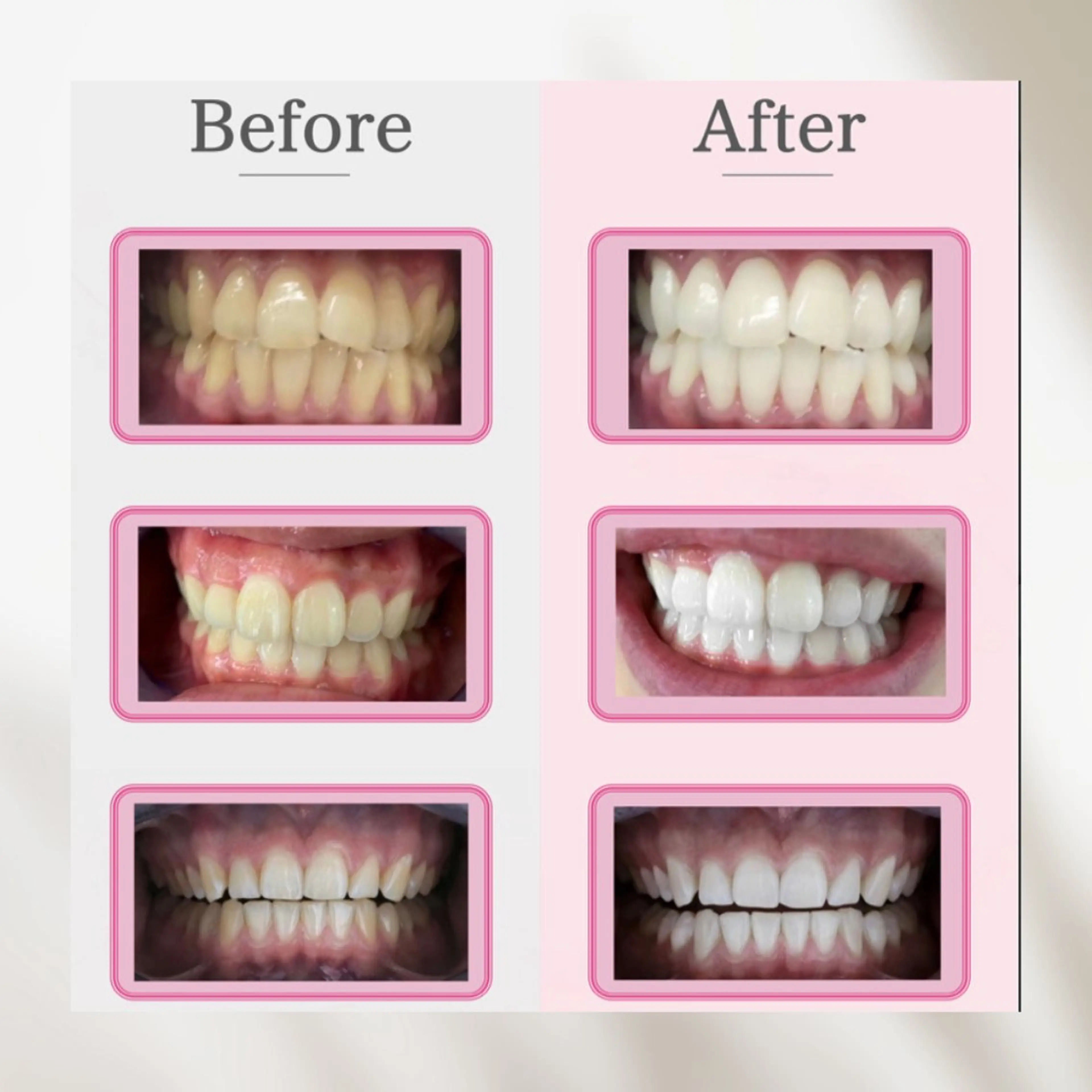 nanami -ホワイトニングのその他イメージ