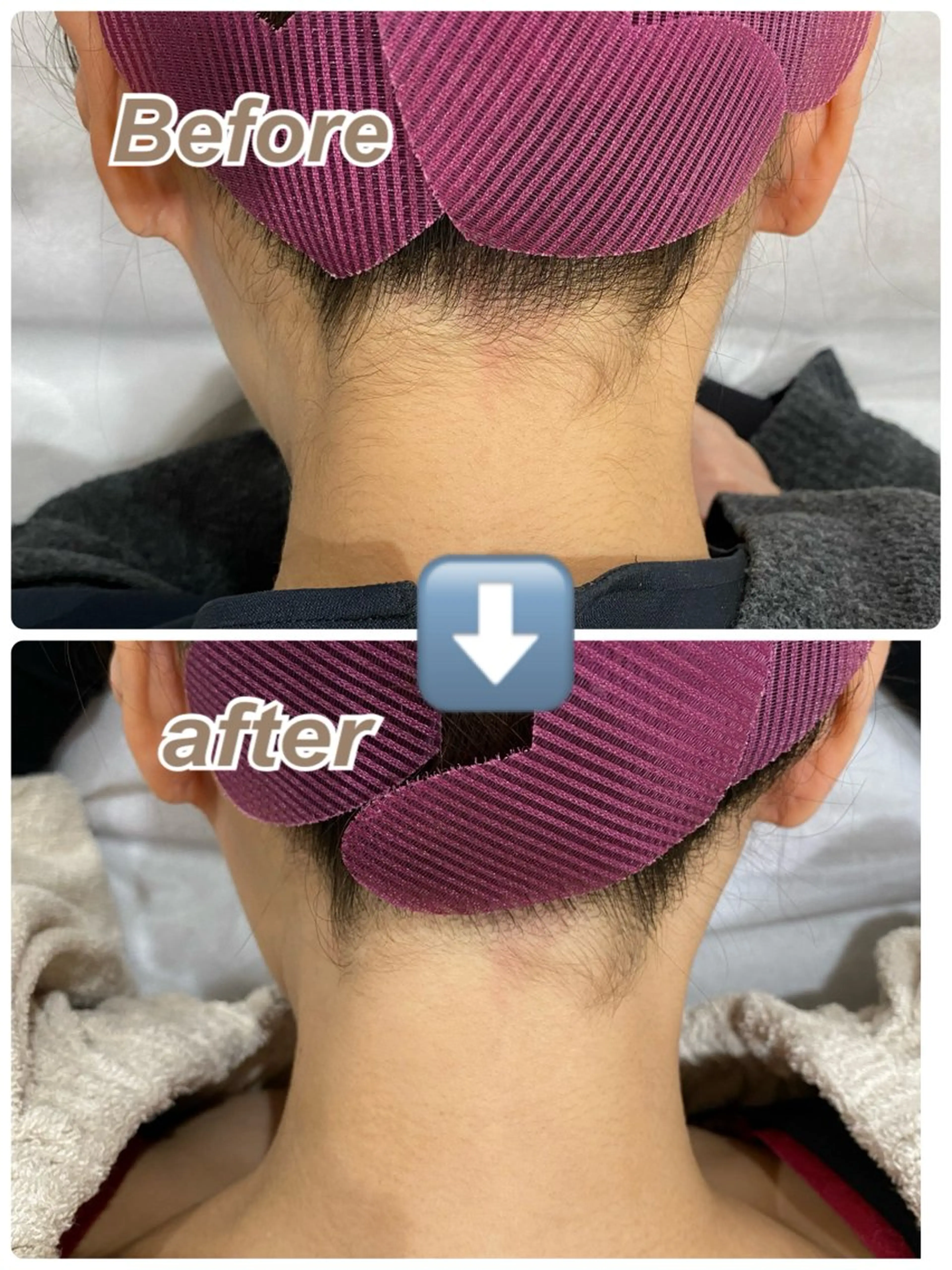 脱毛 🍀SATO MIDORI🍀のエステ・リラクイメージ