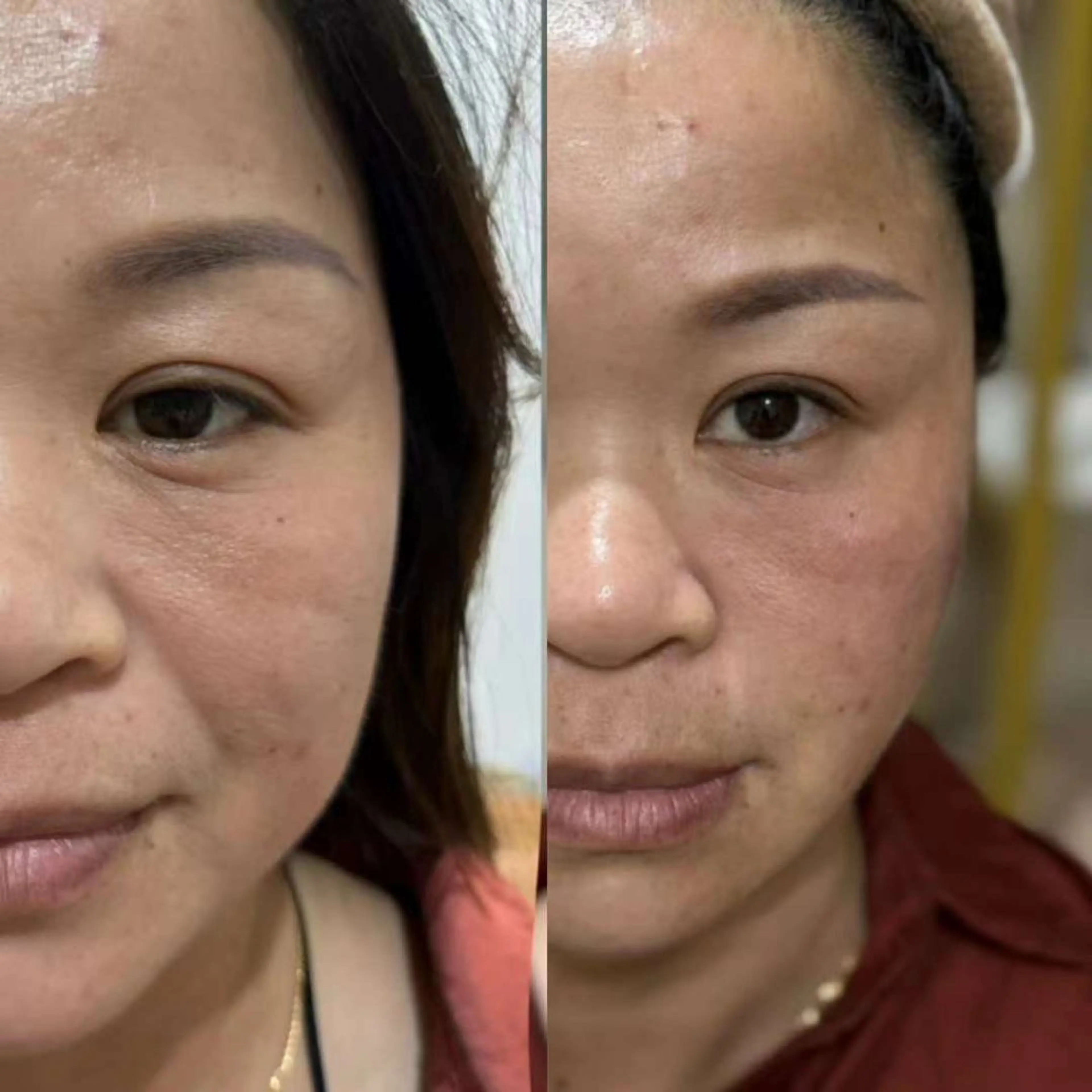 ネイル エステ aliaハーブ水光店 エステティシャン募集のエステ・リラクイメージ