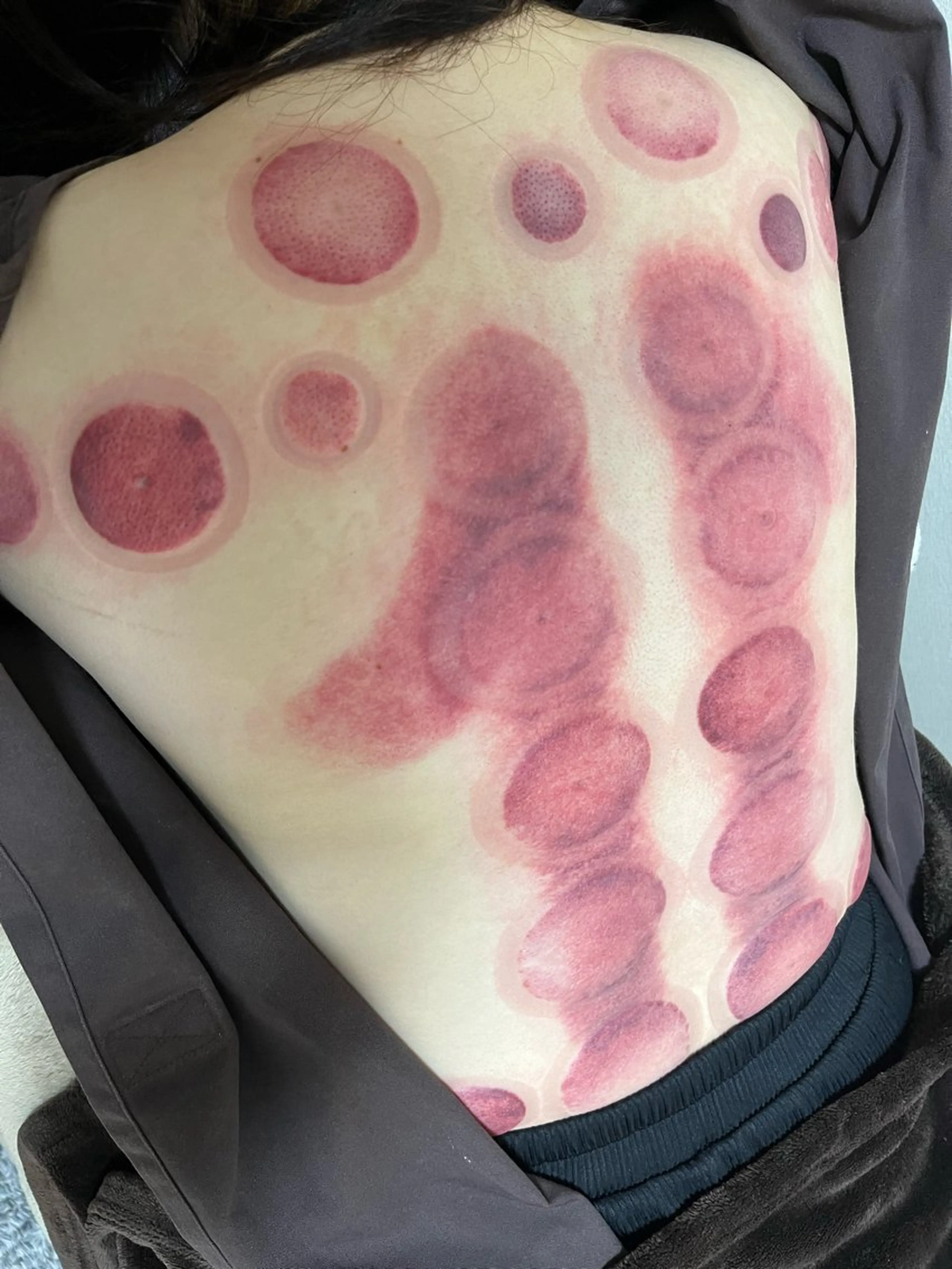 エステ リラク やはた 鍼灸整骨院のエステ・リラクイメージ