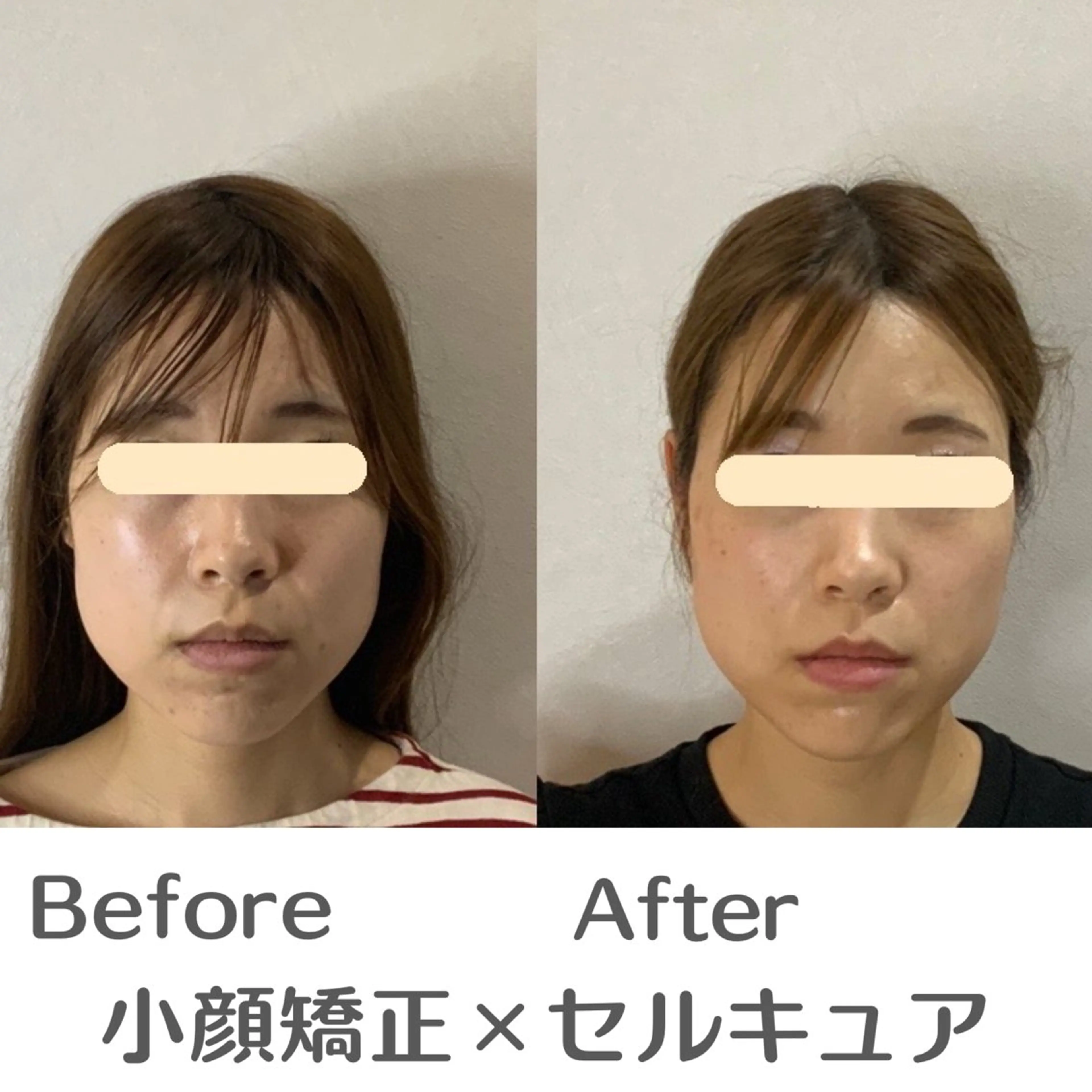 エステ 巻き肩・猫背矯正 小顔　espoirのエステ・リラクイメージ