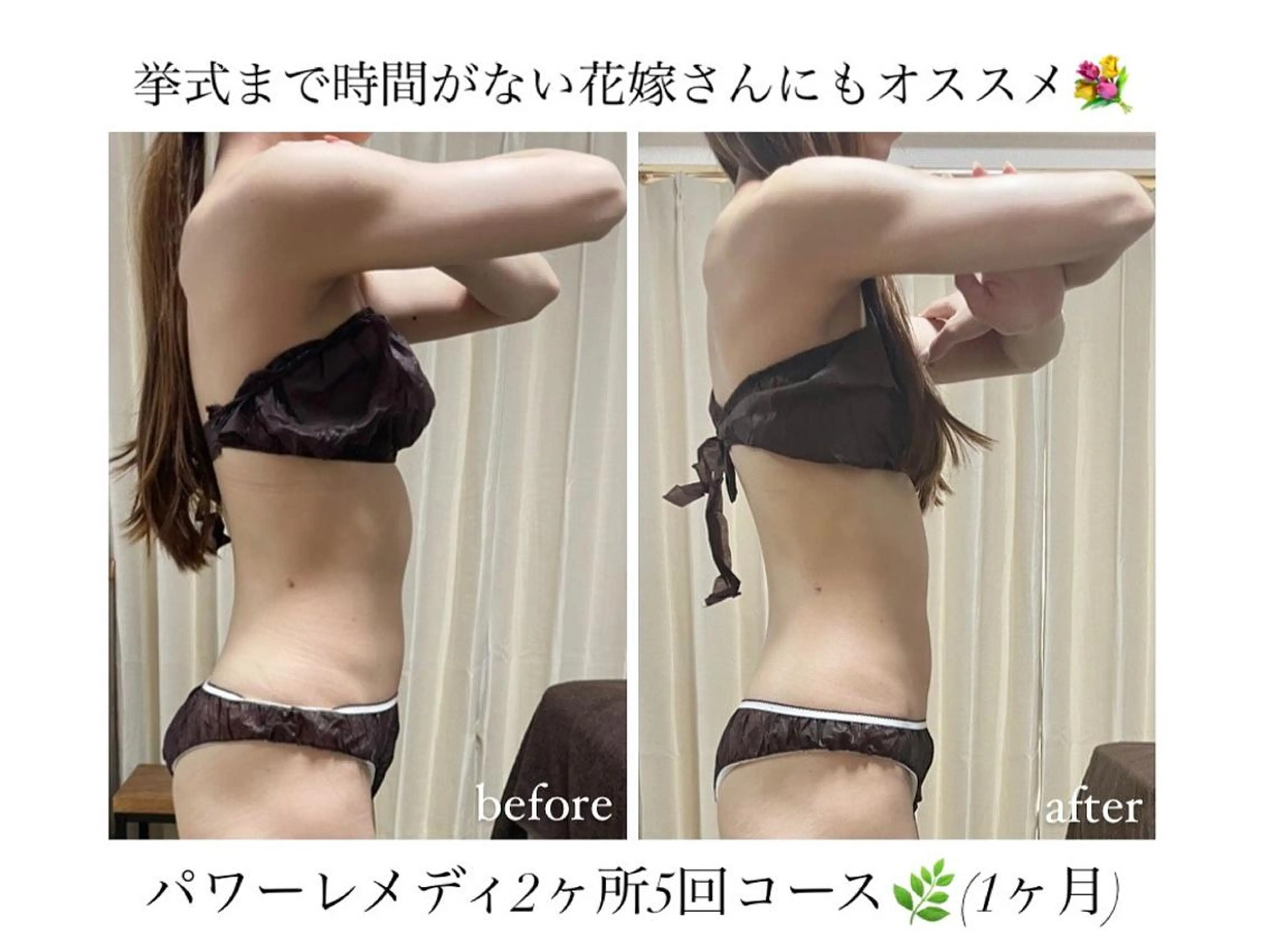 《本気痩せ×疲労改善 》  BILOOPのエステ・リラクイメージ