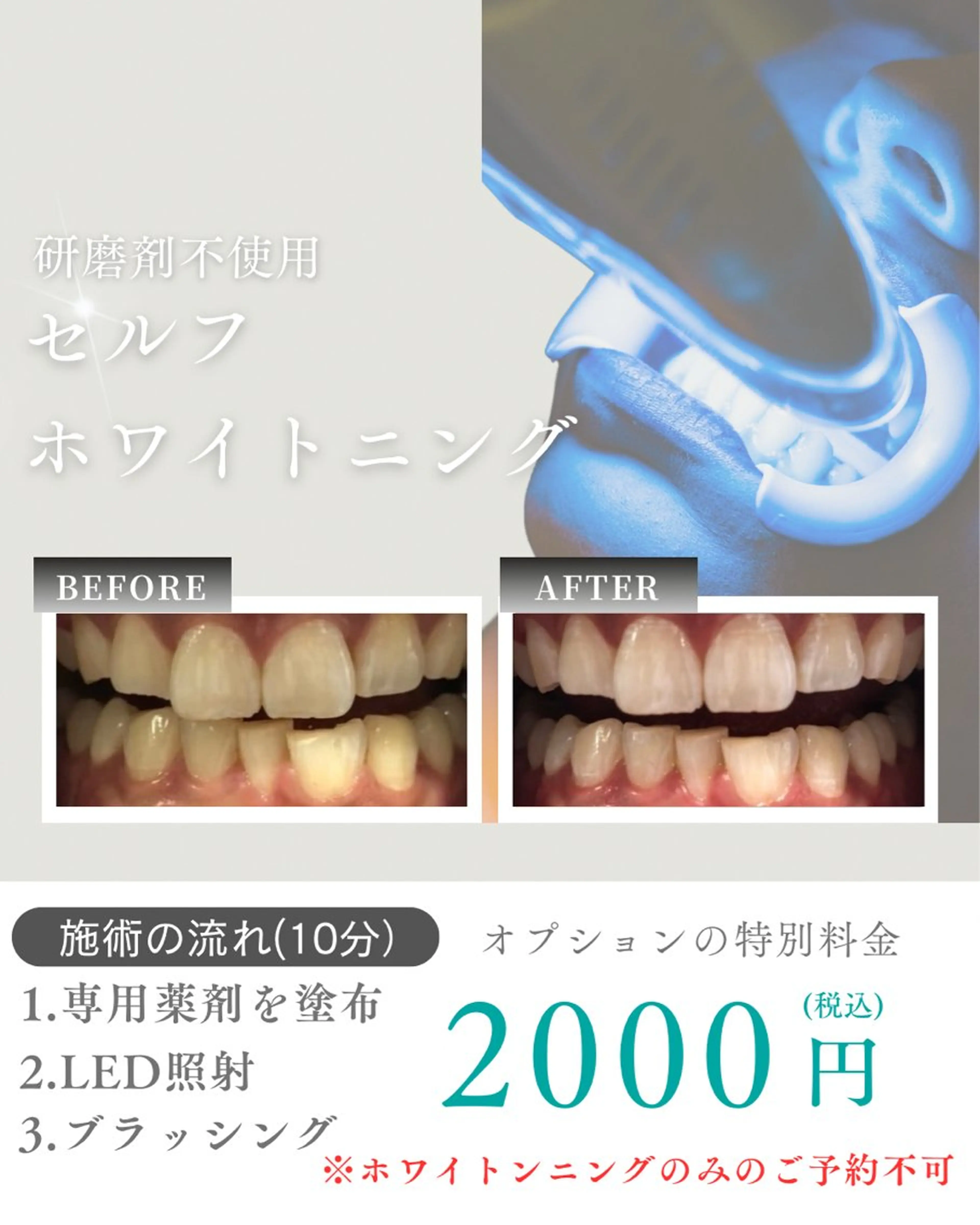 稲垣 優のエステ・リラクイメージ