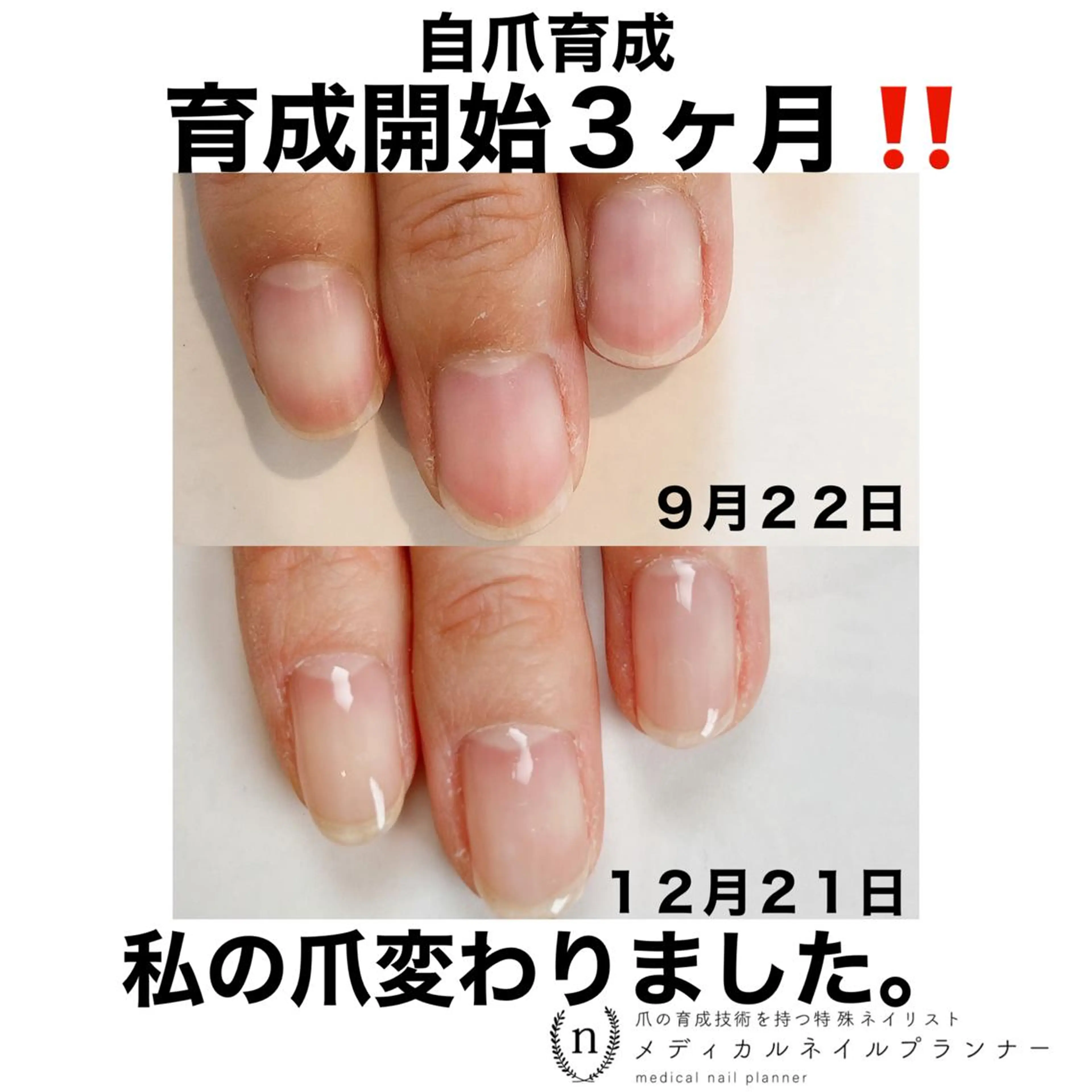 ネイル NAIL SALON ｔｏｇｇｙのネイルデザイン