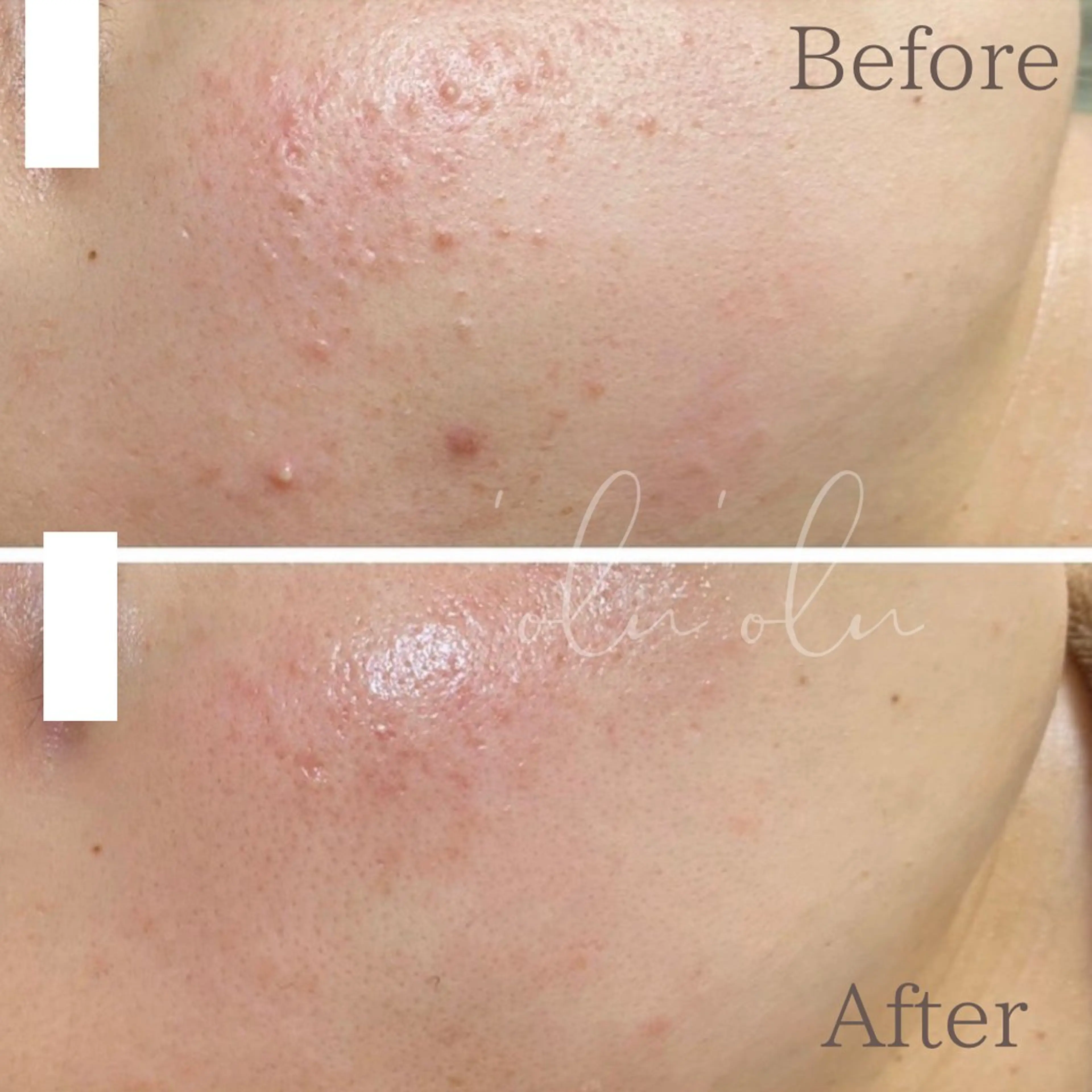 'Olu'Olu シミ・毛穴専門サロンのエステ・リラクイメージ