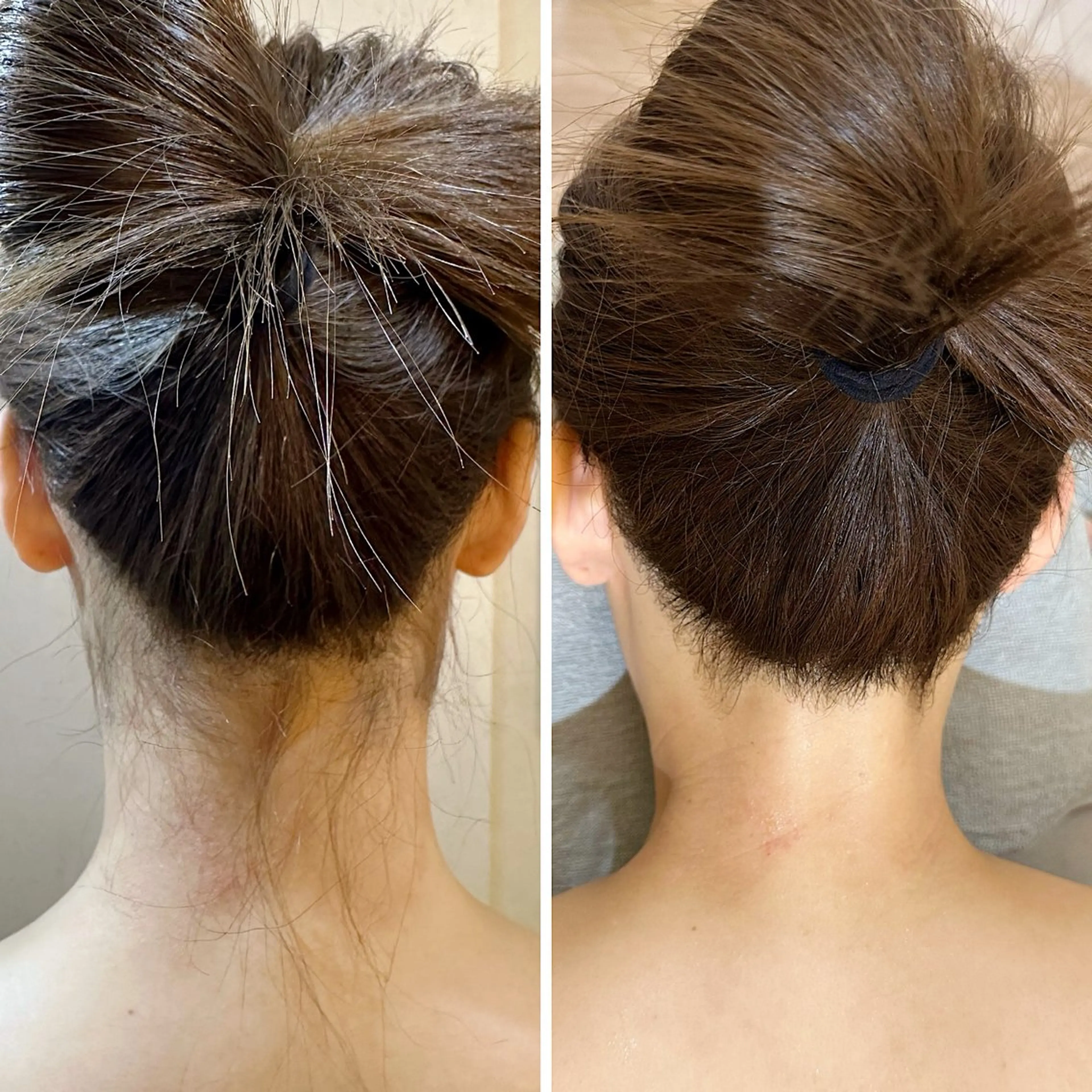 脱毛 うなじ脱毛/美肌脱毛 LABELのエステ・リラクイメージ