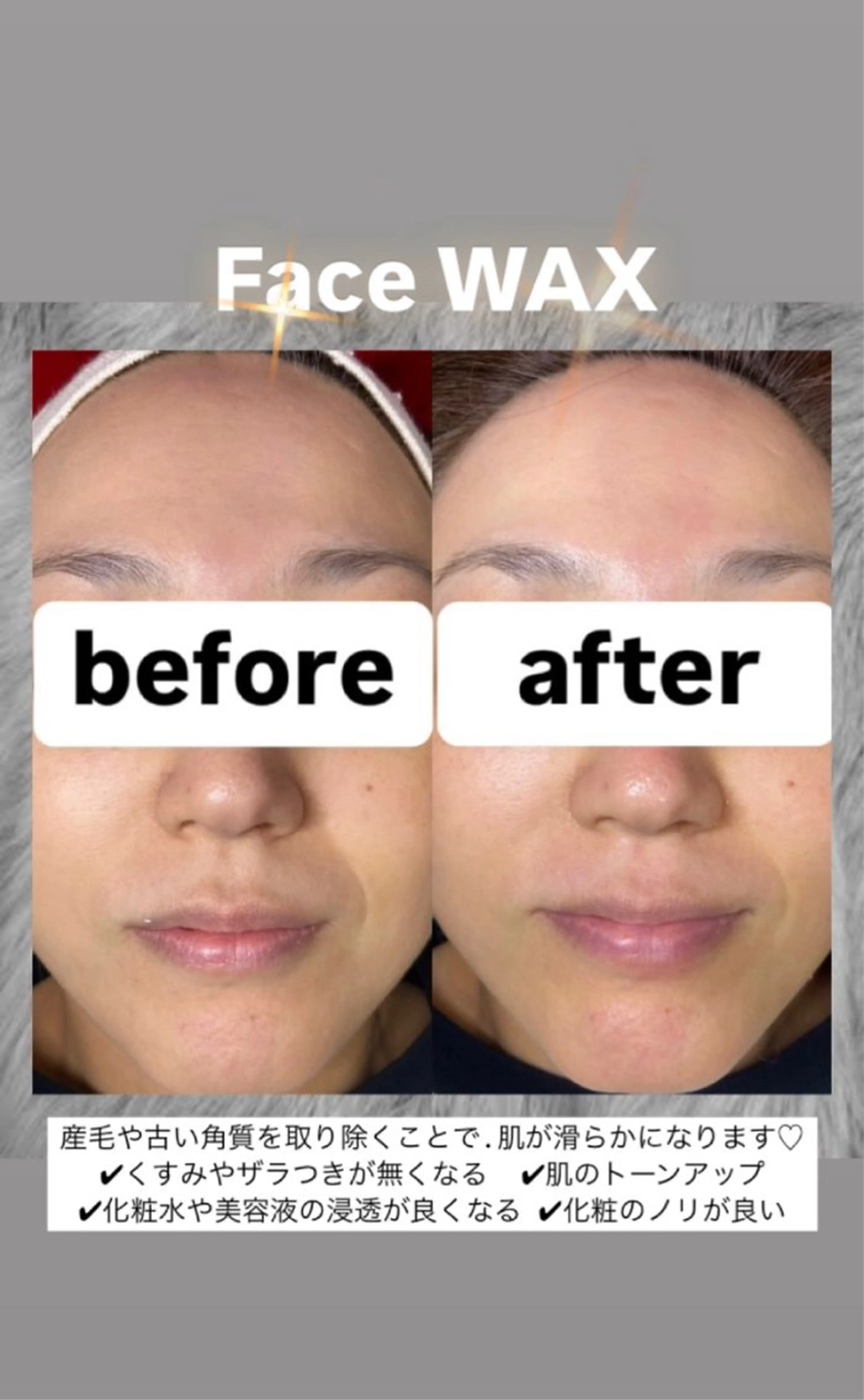 🩵ྀིご新規価格！🩵ྀིフェイスWAX✨＊保湿マスク仕上げ付きの写真