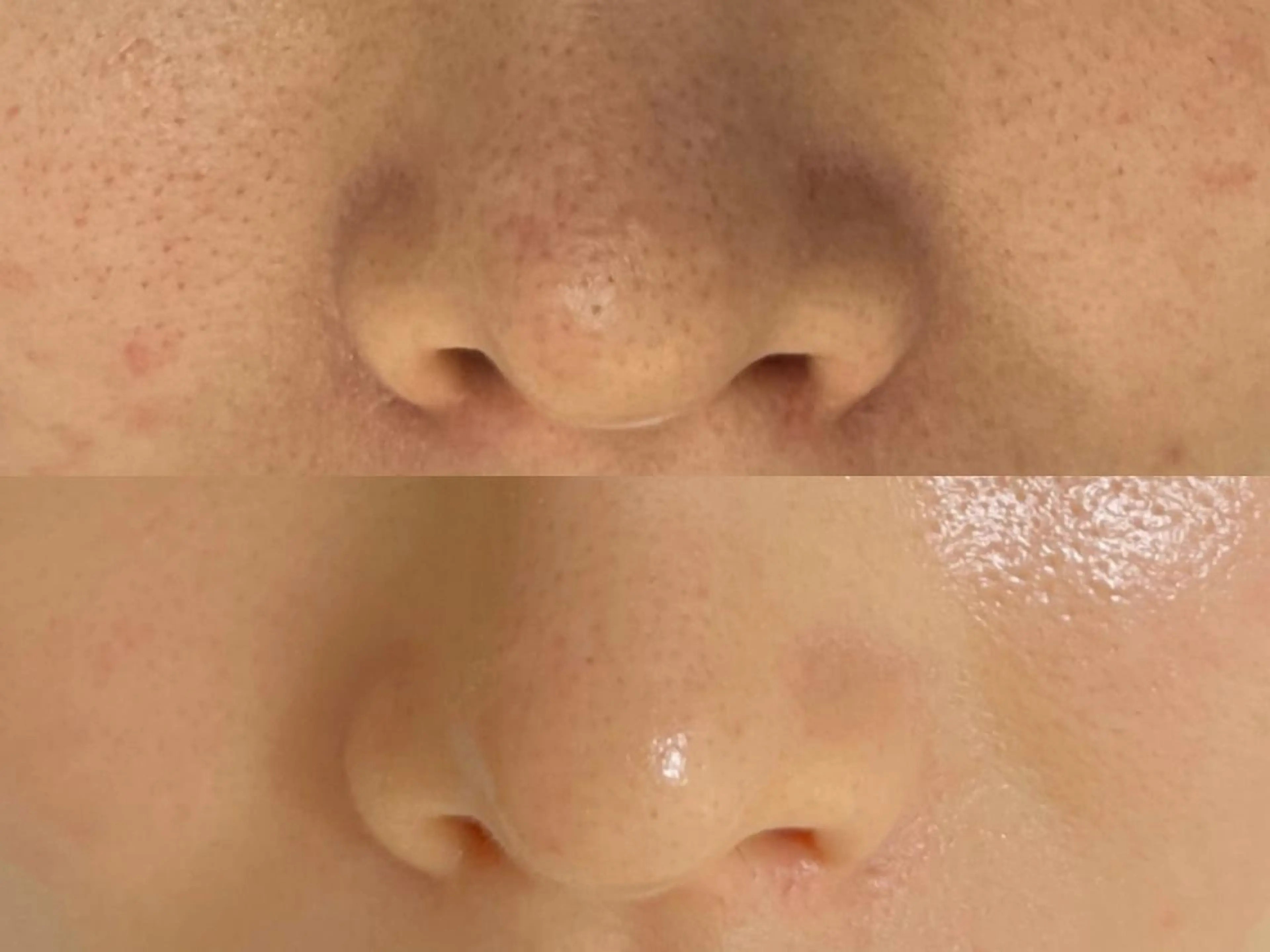 ♡4U NAIL& 韓国美容＆ネイル♡のネイルデザイン