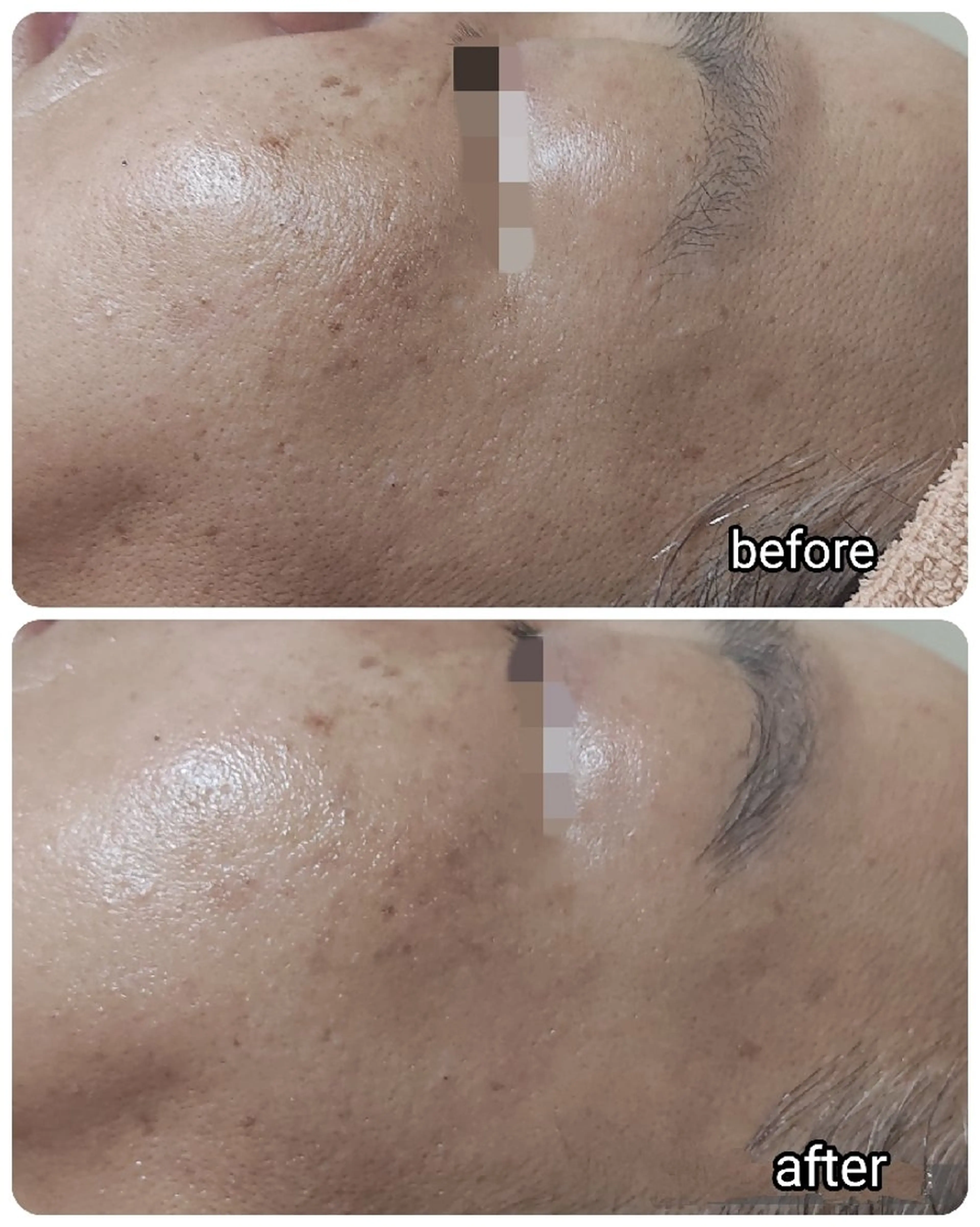 山野愛子どろんこ美容 Laughのその他イメージ