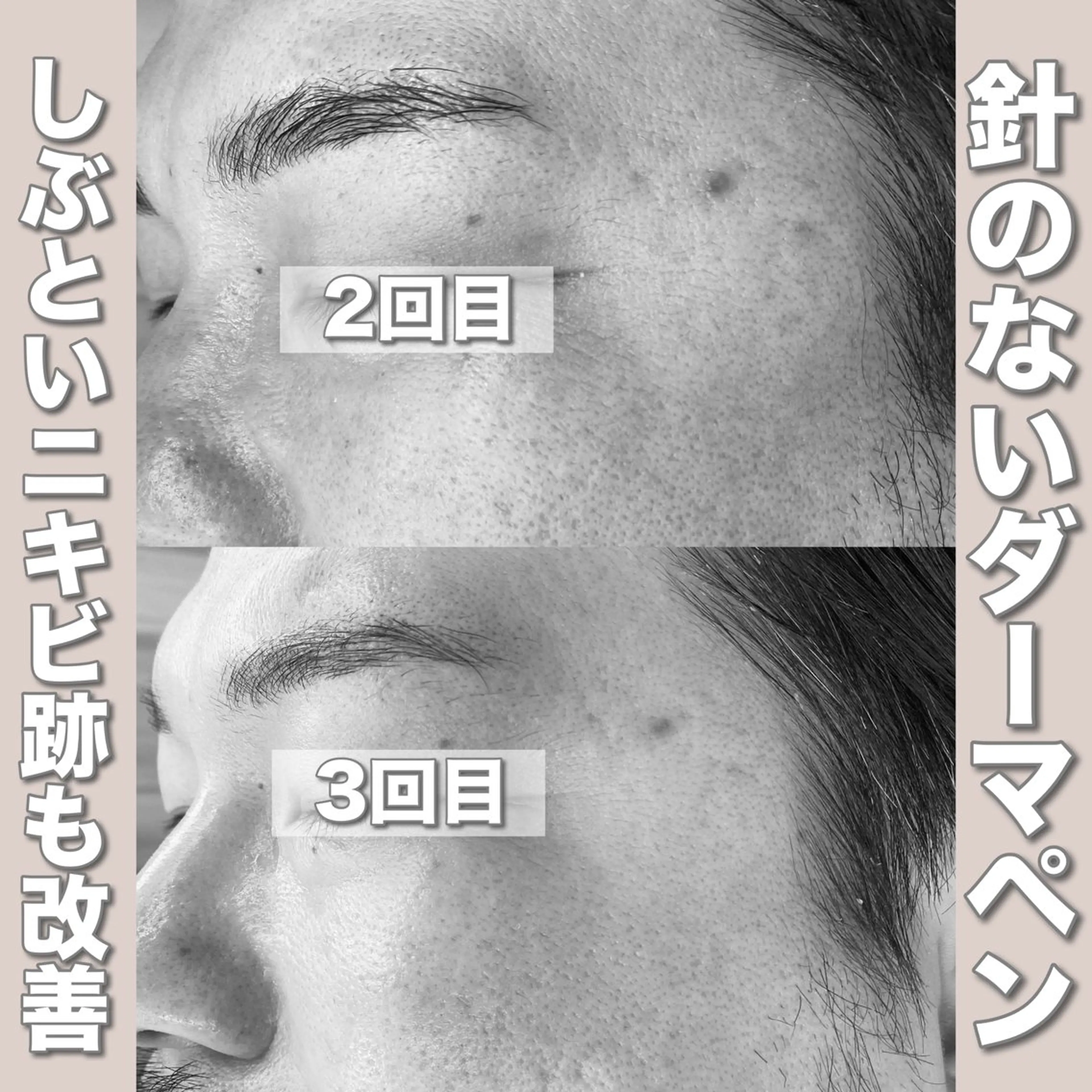 エステ mone~total care salon~所属・mone (モーネ)のエステ・リラクイメージ