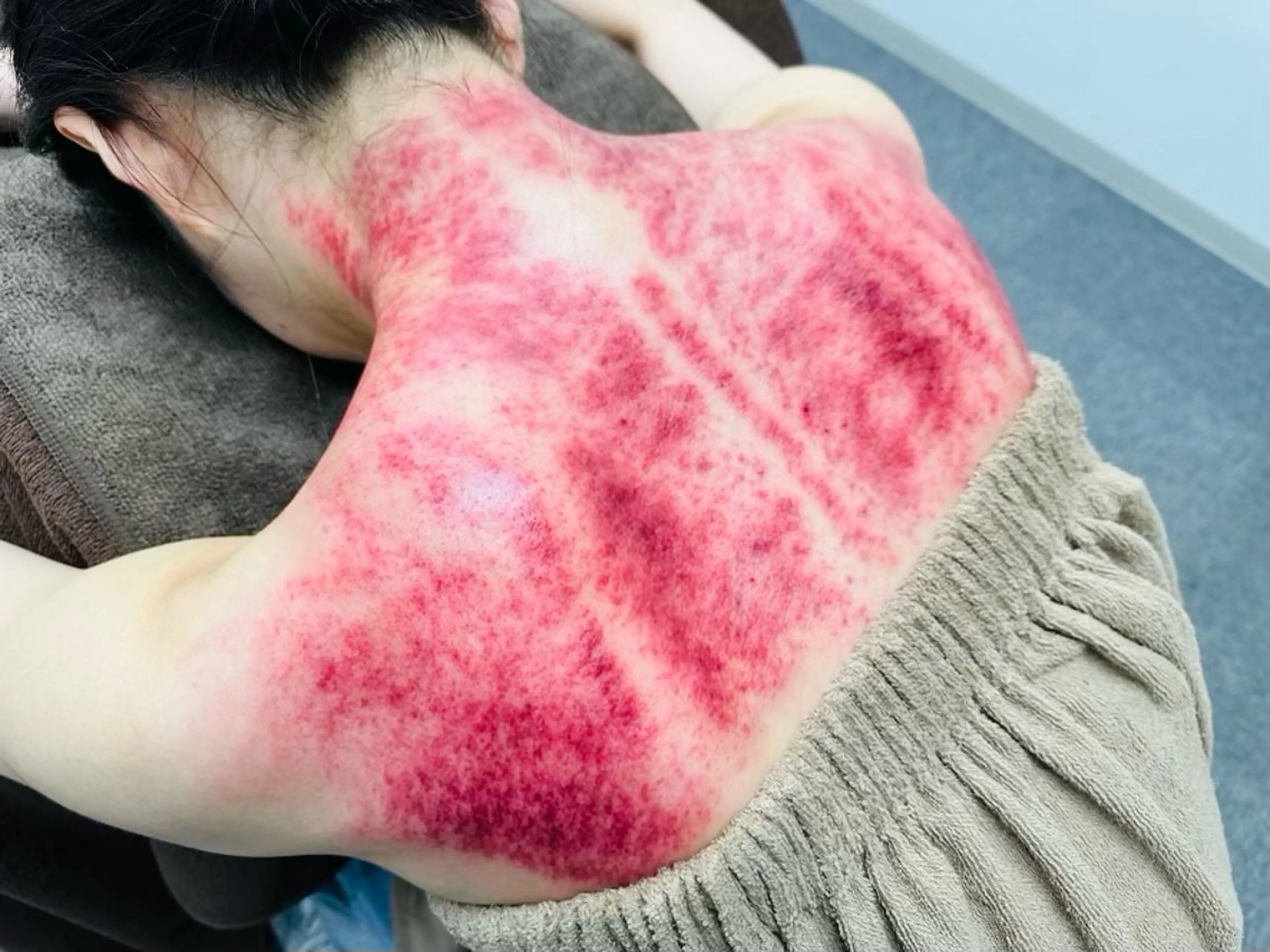 台湾式カッサ(首/肩)の写真