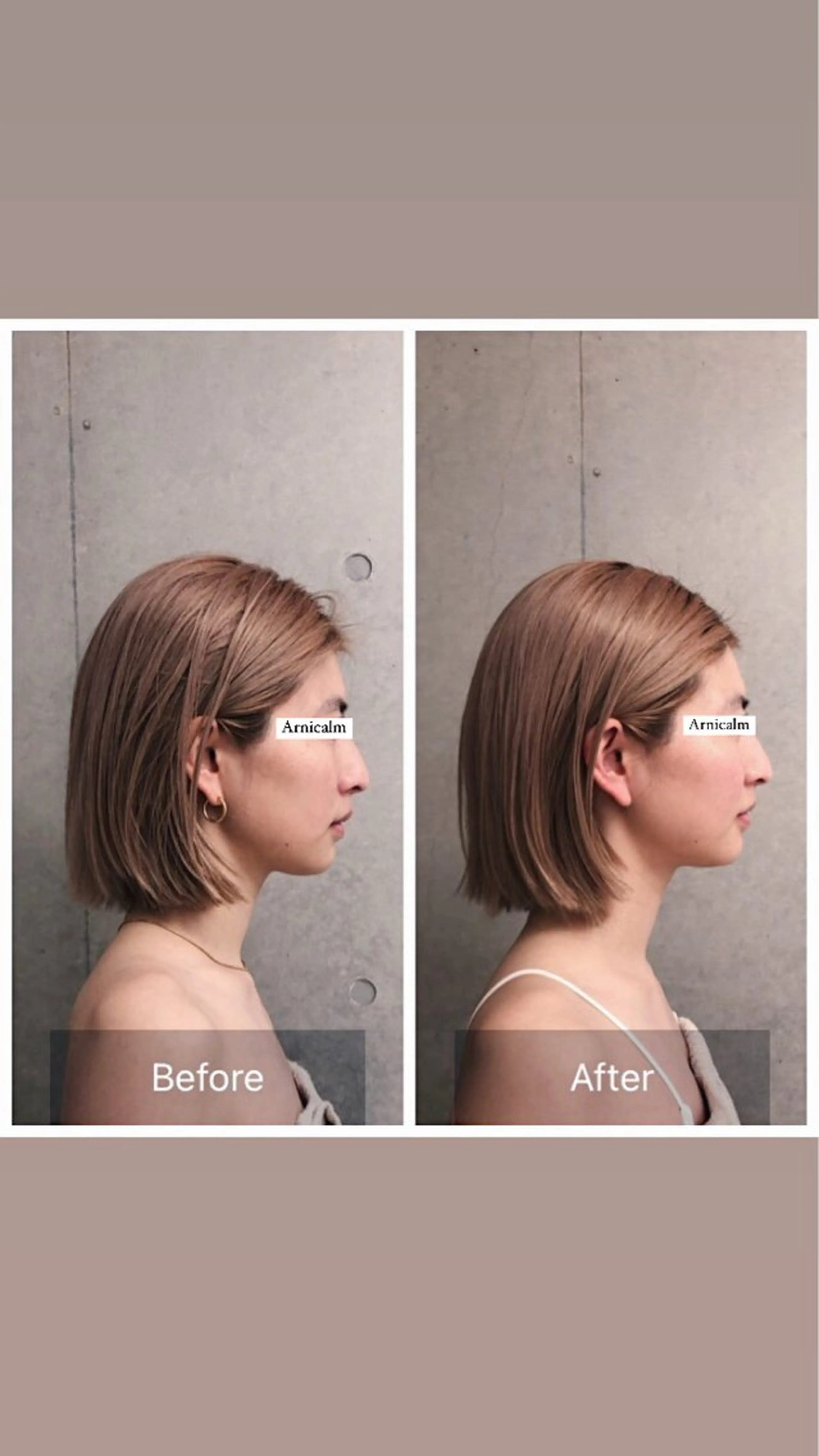 ハーブピーリング 肌再生ピーリング/のエステ・リラクイメージ