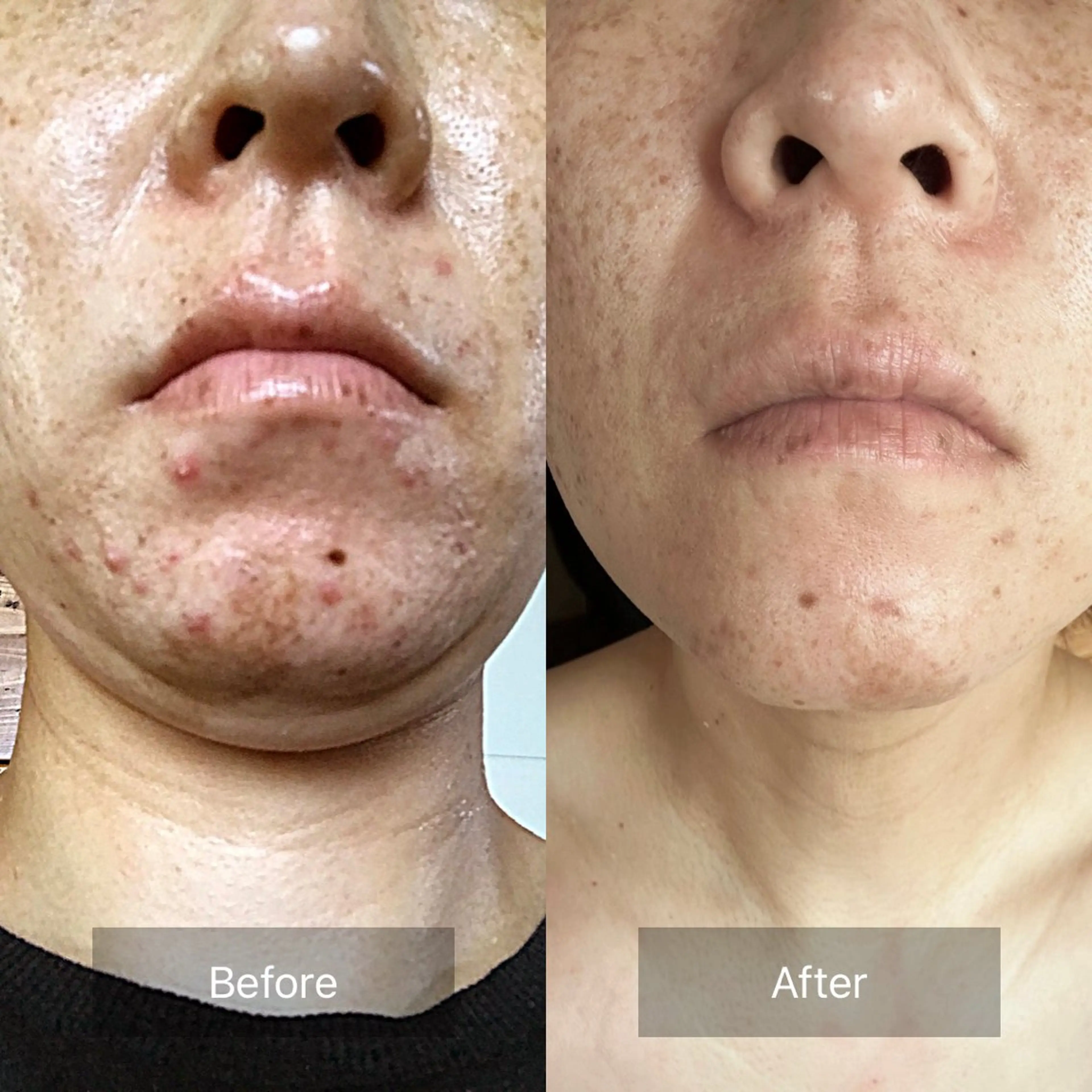 ヌーベル プリュムのその他イメージ