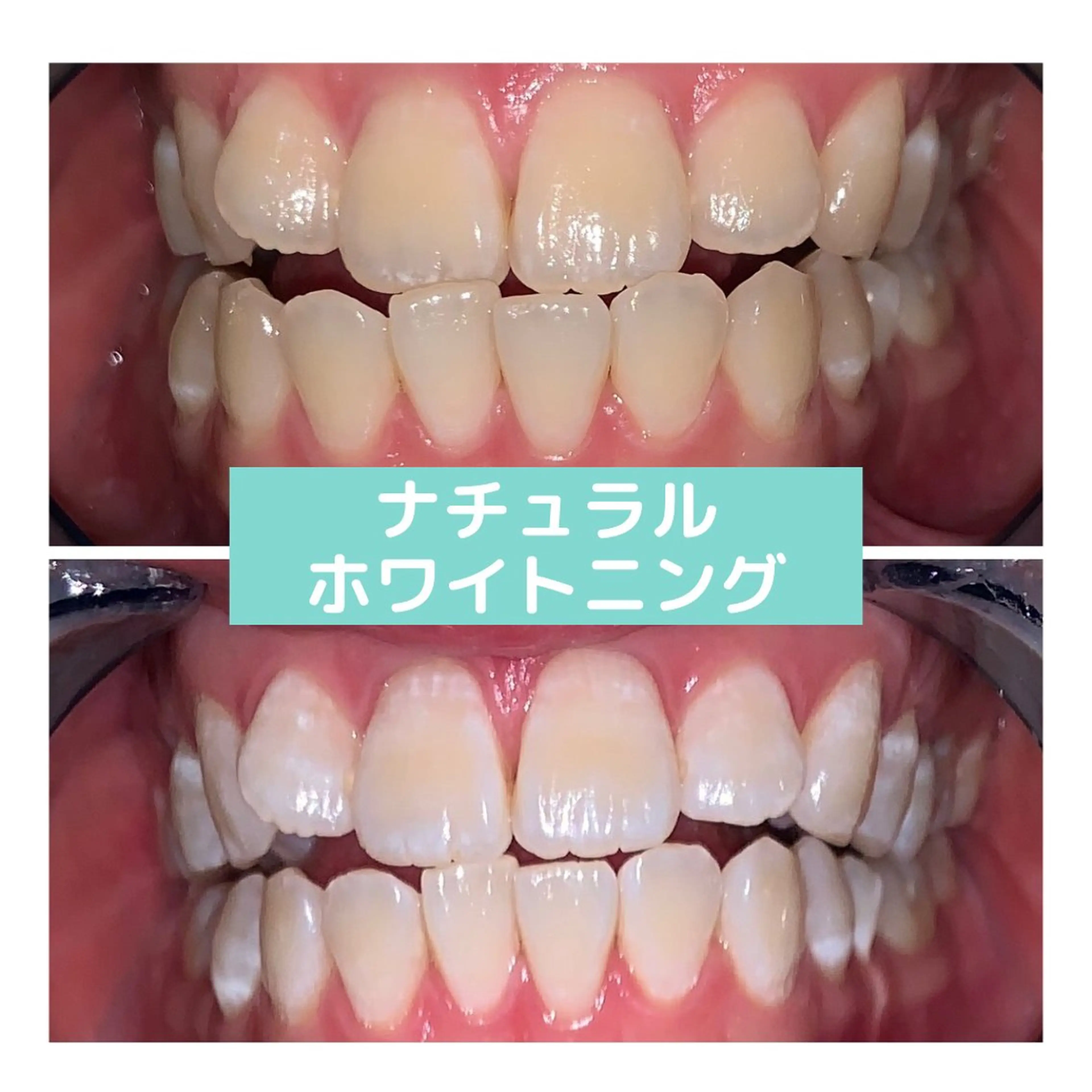 韓国式3D毛穴洗浄 lonhanaのその他イメージ