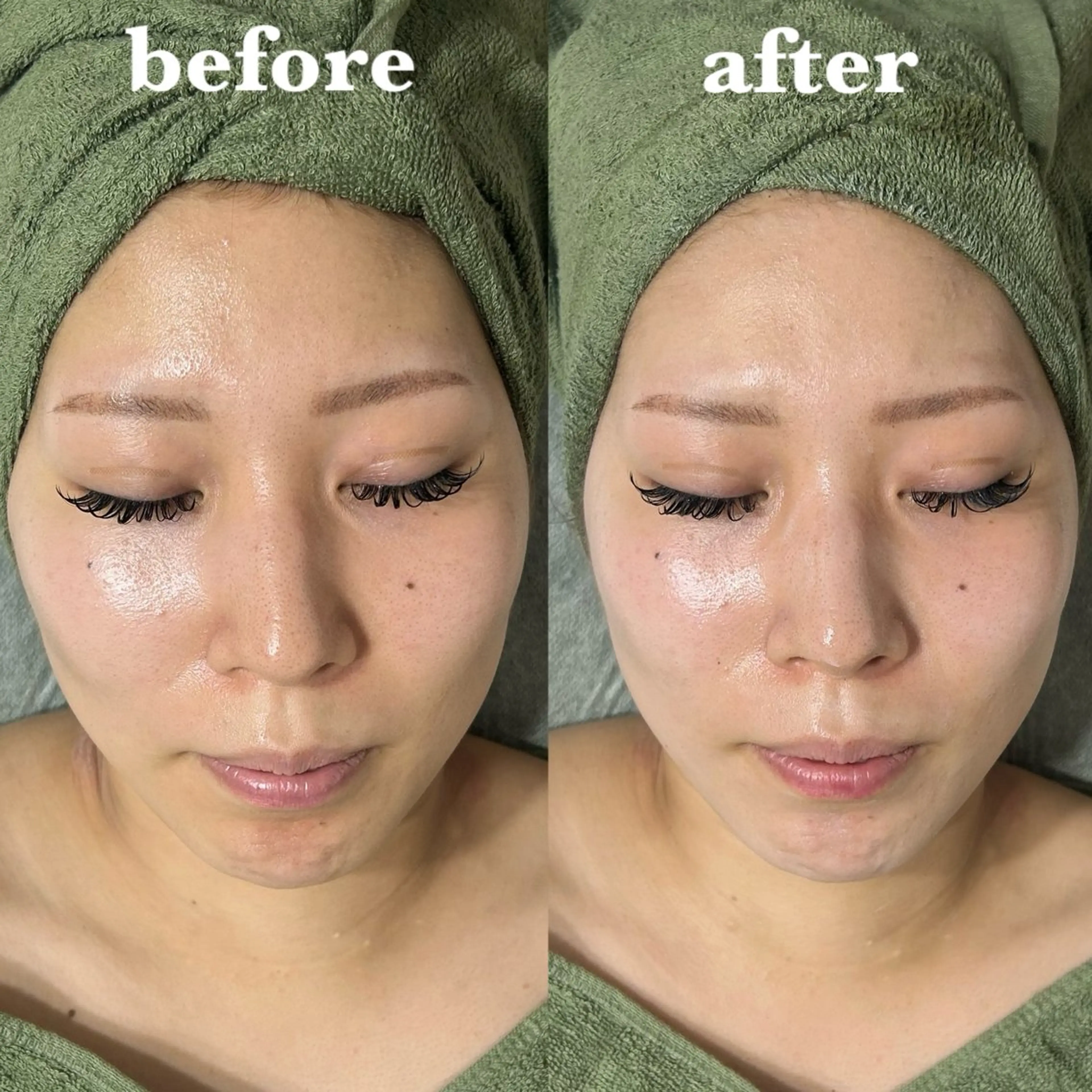 肌質改善＆脱毛 【M Mondo】のエステ・リラクイメージ