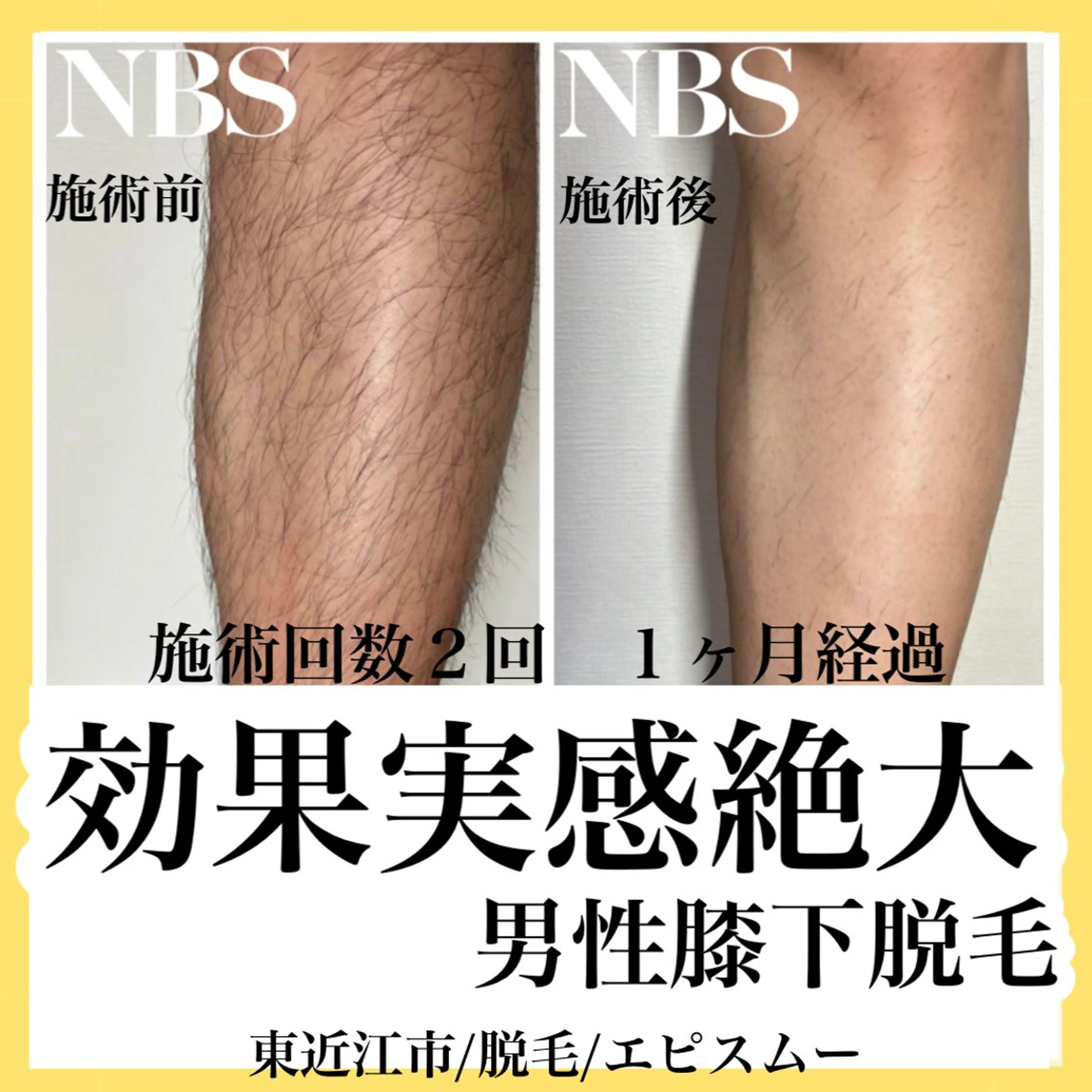 メンズ epismoo 脱毛/HBL/毛穴の眉毛・アイブロウイメージ