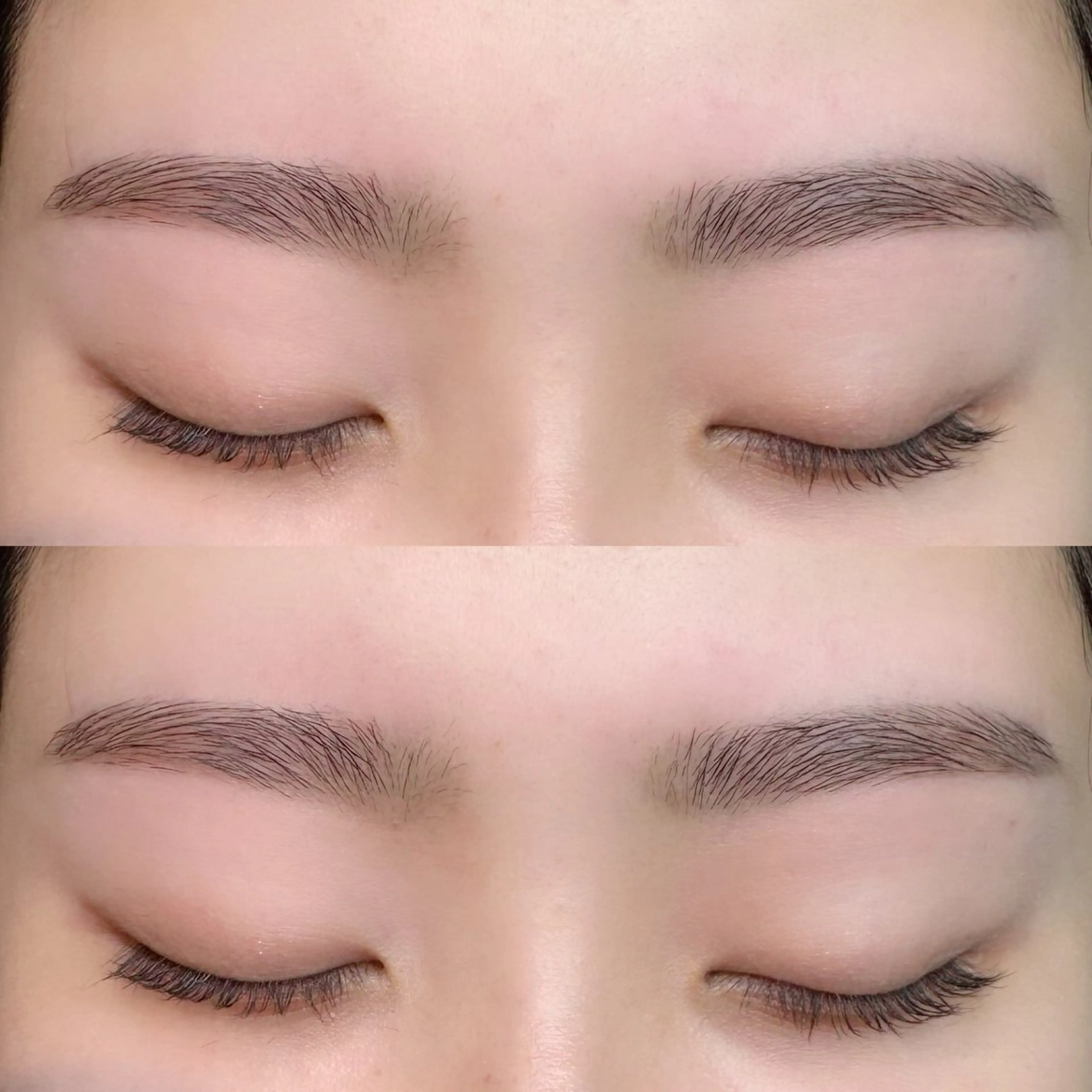 アイブロウ脱毛の写真