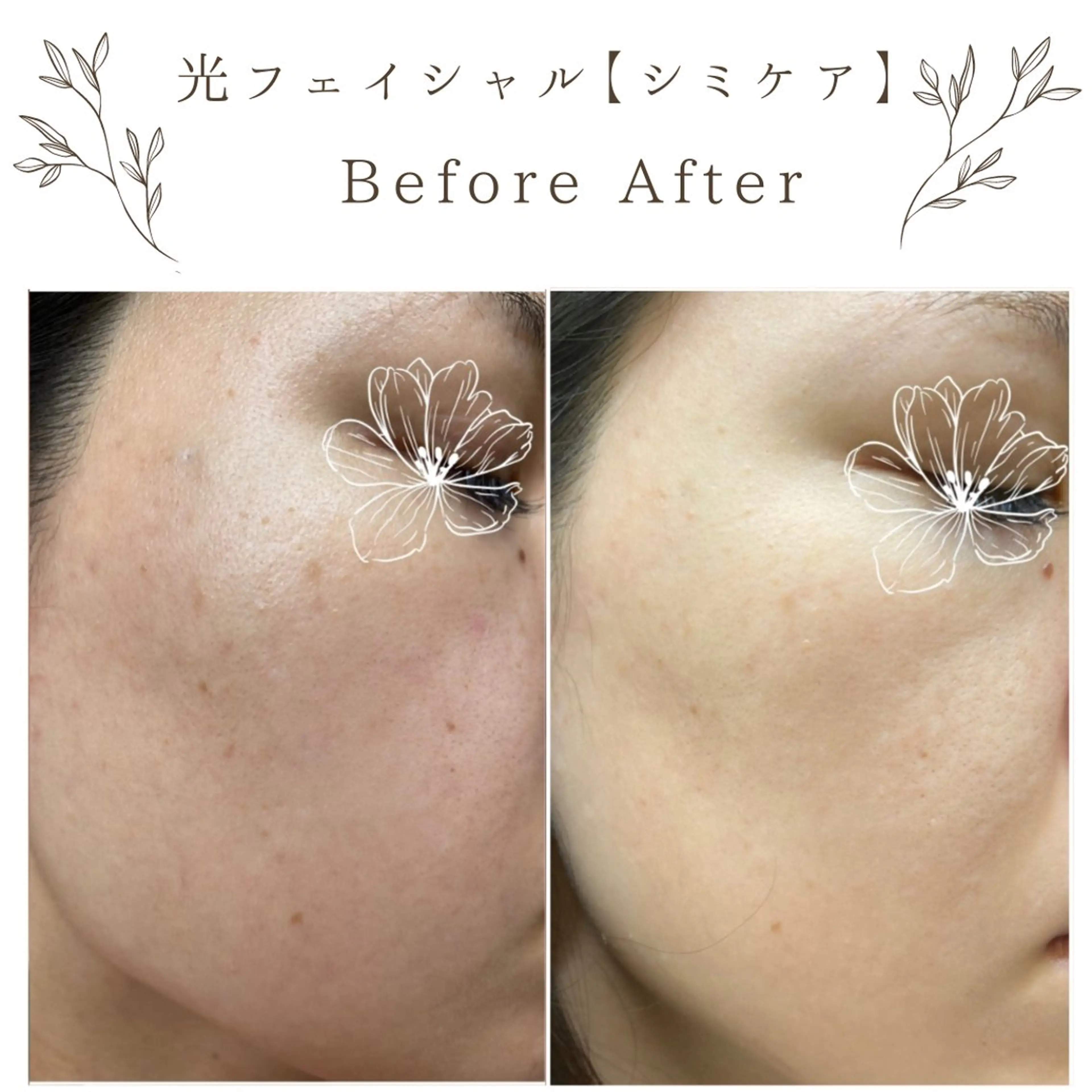 な ぎのエステ・リラクイメージ