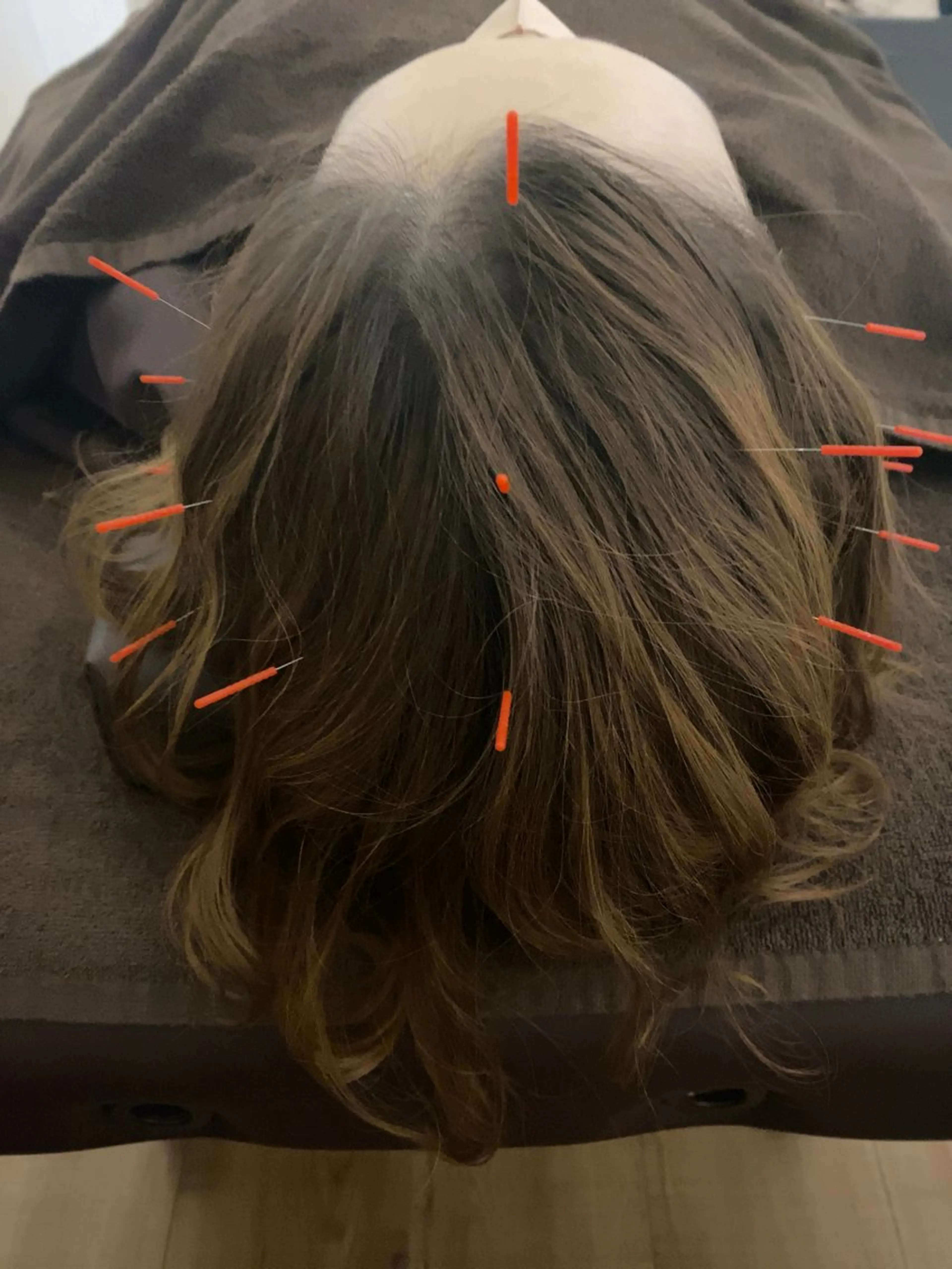 自律神経&睡眠改善！ドライヘッドスパ鍼灸100分(足浴含む)の写真