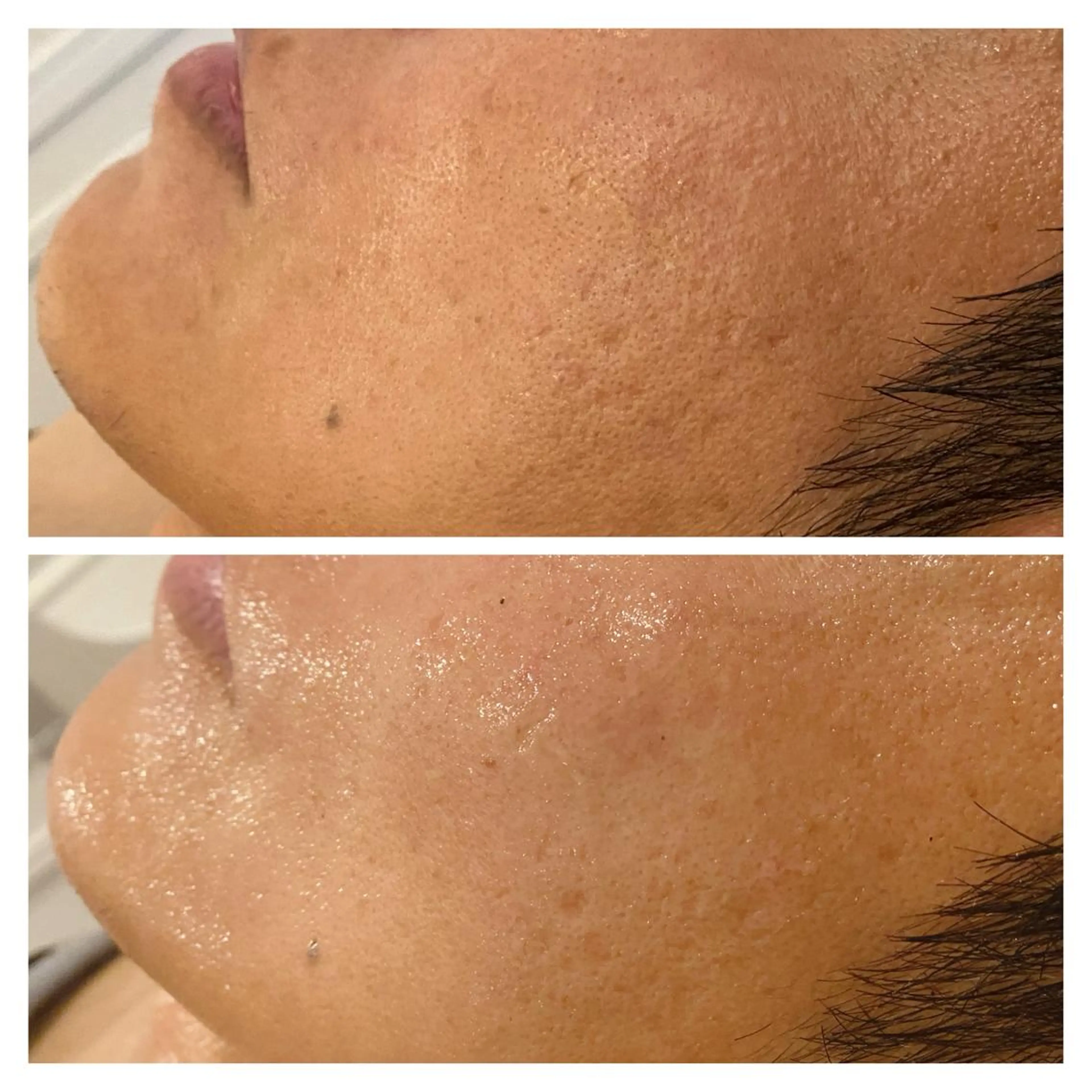 小顔EX心斎橋 REVIハーブのエステ・リラクイメージ