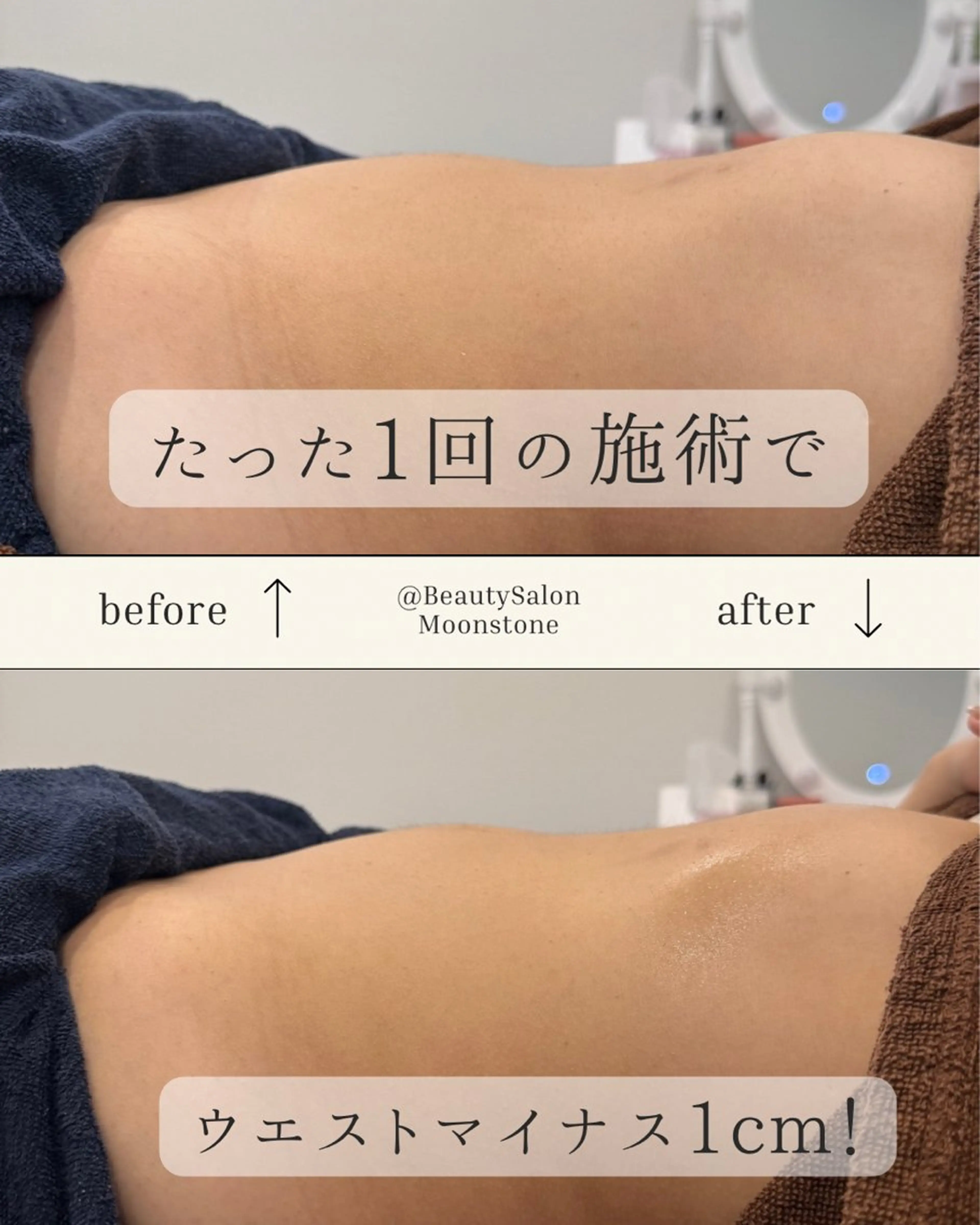 Beauty Salon Moonstone所属・Moonstone 腸活ダイエット・脱毛のエステ・リラクイメージ