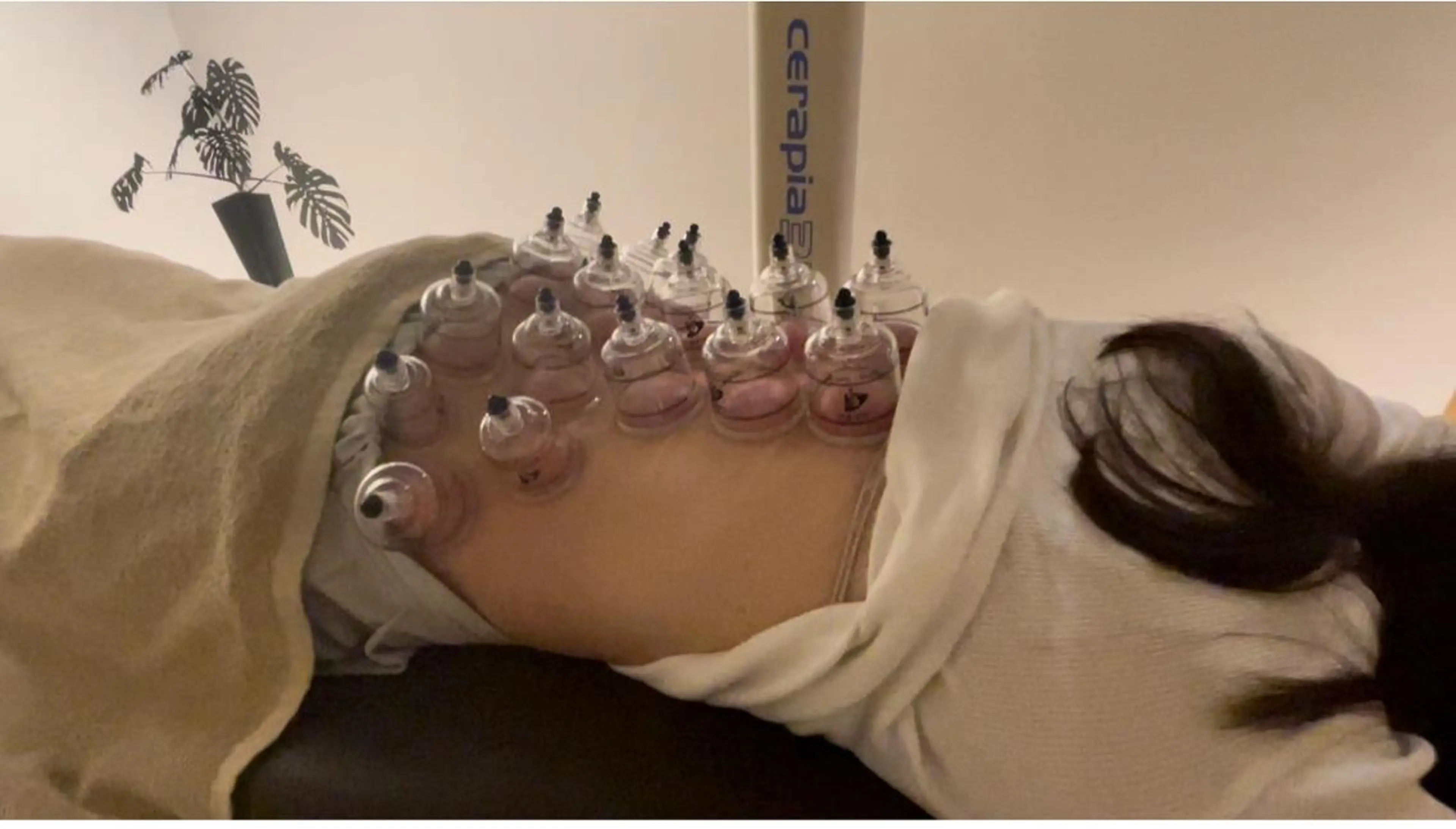 鍼灸 Refineのその他イメージ