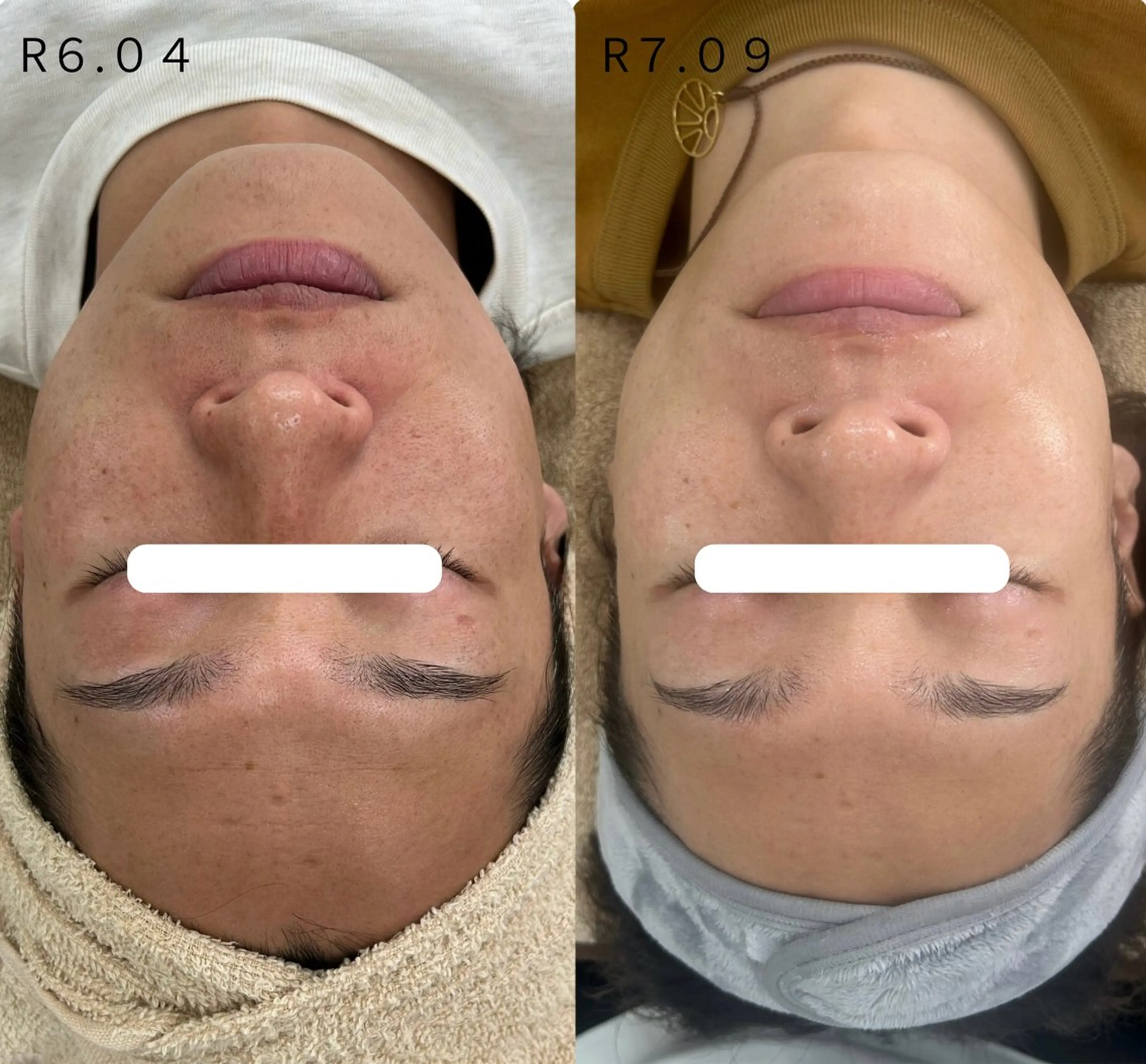 エステ Venus所属・エステサロン Venusのその他イメージ