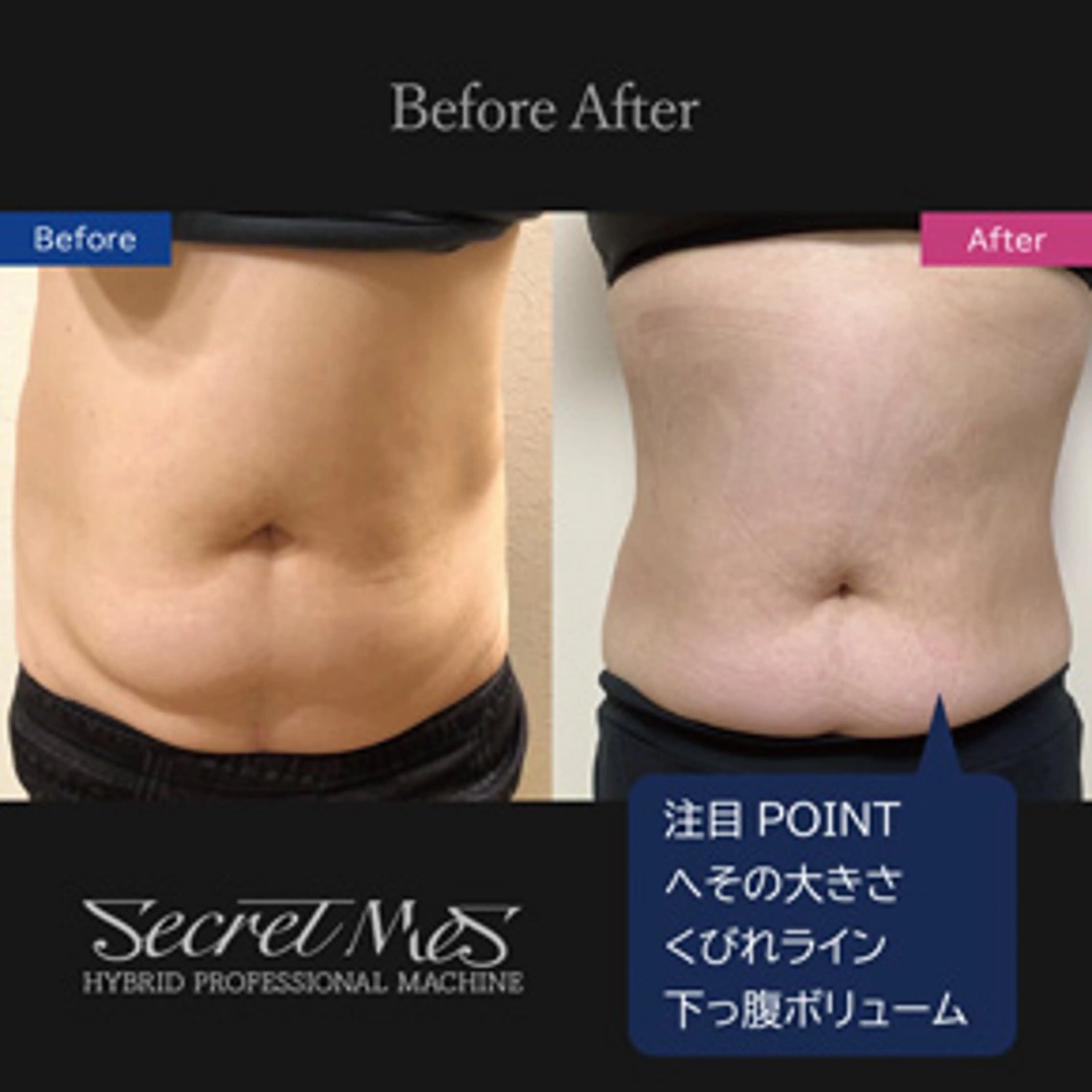 伊藤 正美のマツエク・マツパデザイン