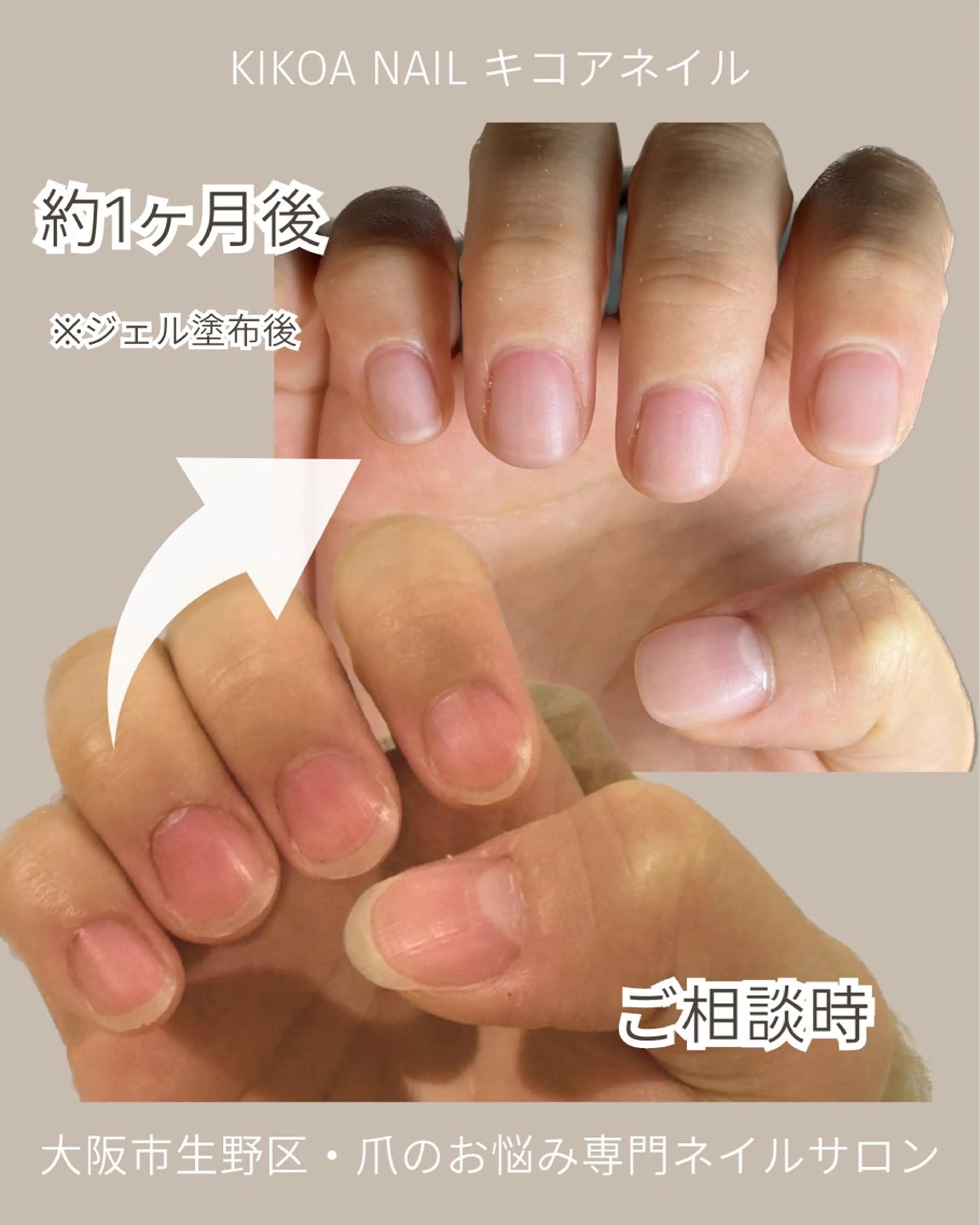 ネイル ジェルネイル KIKOA NAIL キコアネイルのネイルデザイン