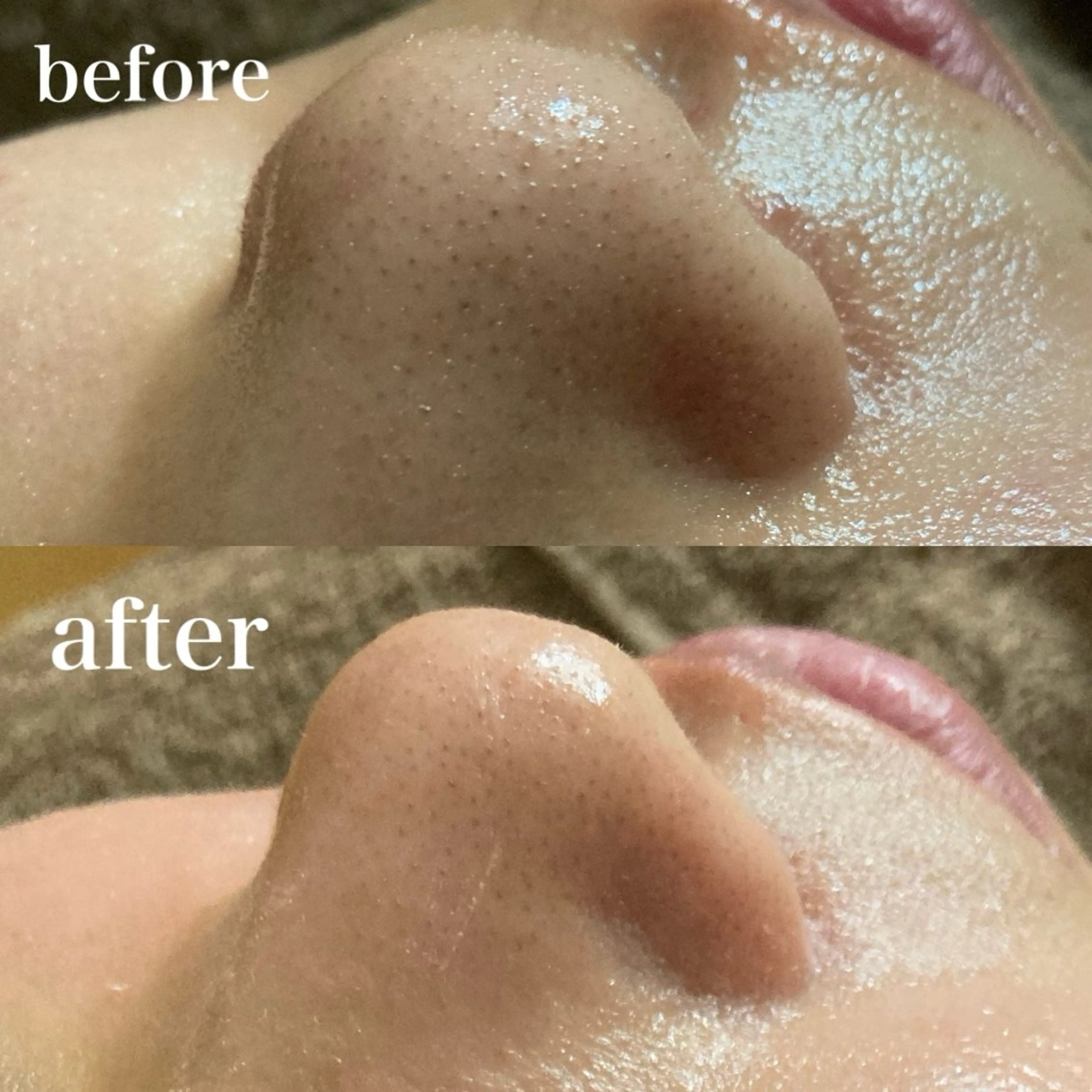 磐田｜LAYLA 一番丁寧な脱毛店のエステ・リラクイメージ