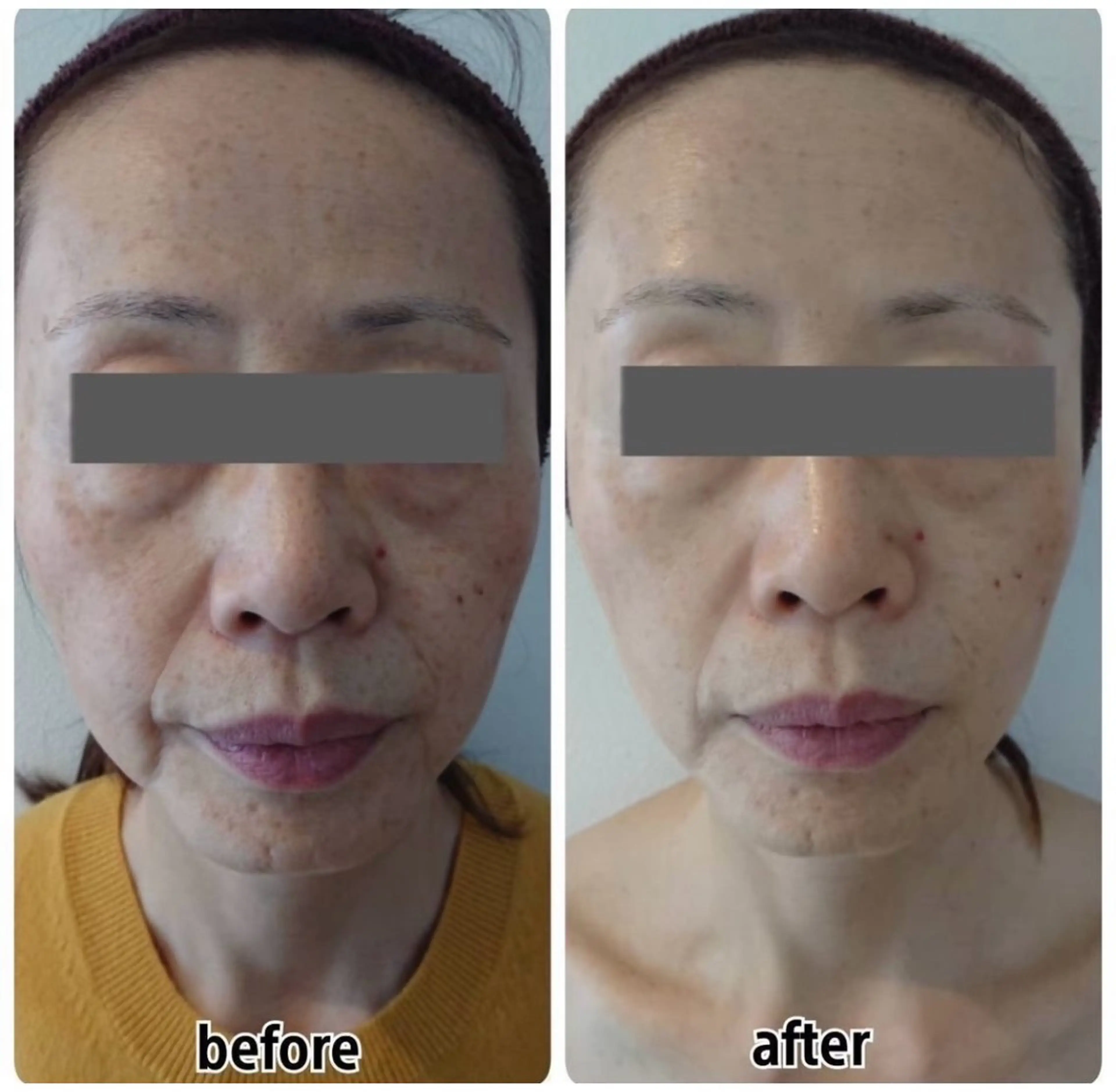 エステ Esthe salon Blanche(エステサロンブランシュ)所属・小顔リフトアップ 美肌改善専門店のエステ・リラクイメージ