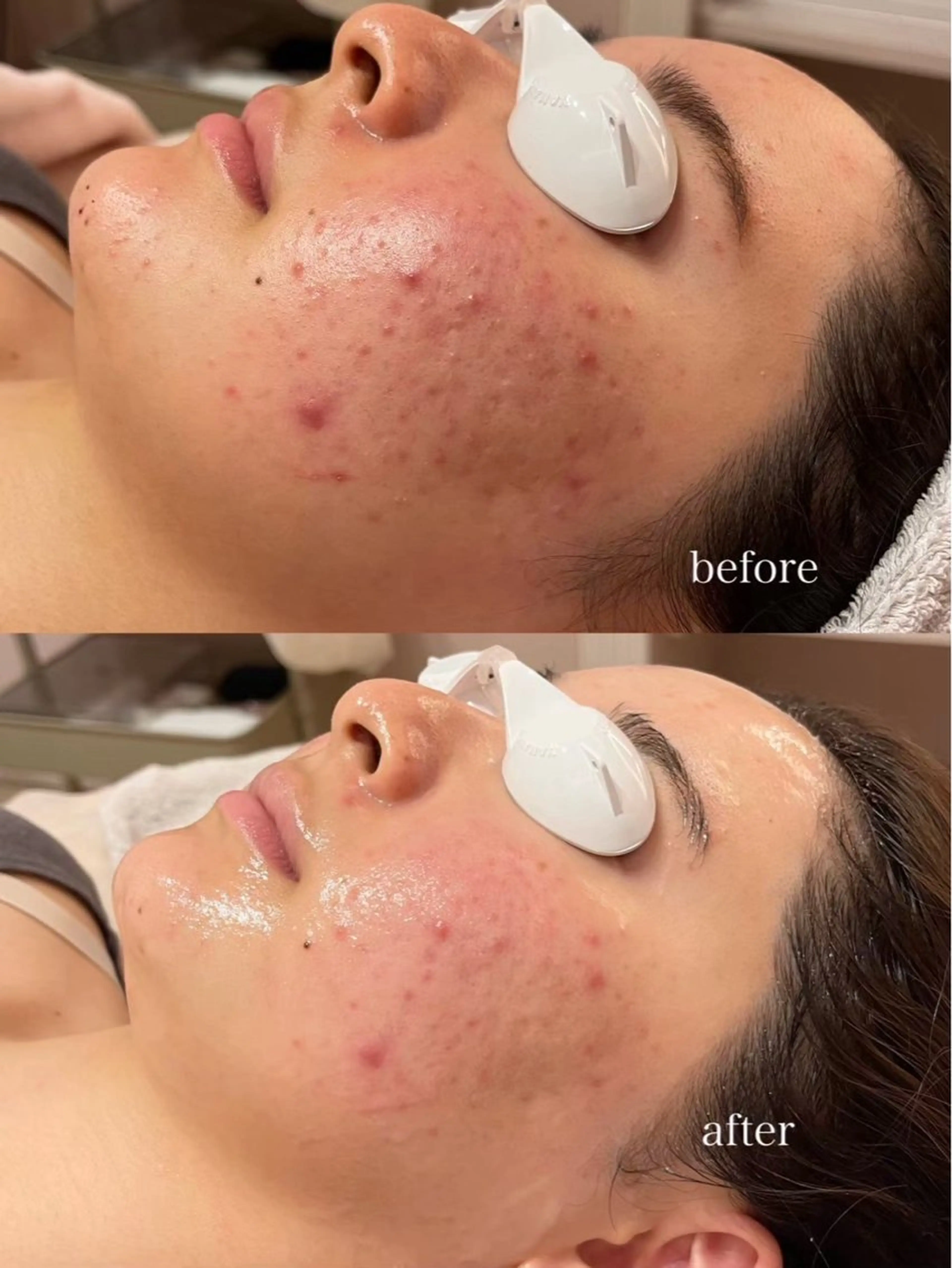 エステ SAERA yuyuのエステ・リラクイメージ