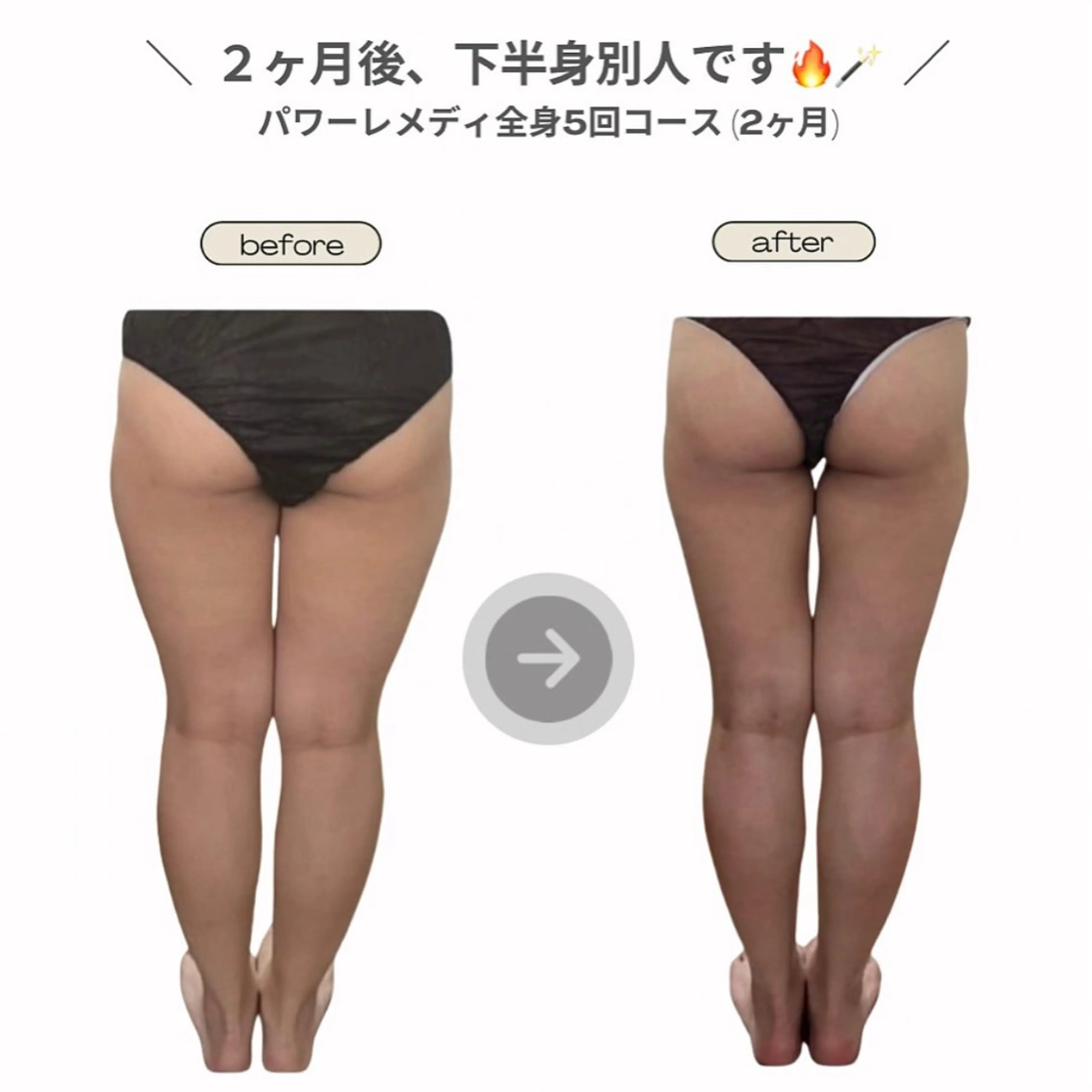 エステ リラク 《本気痩せ×疲労改善 》  BILOOPのエステ・リラクイメージ